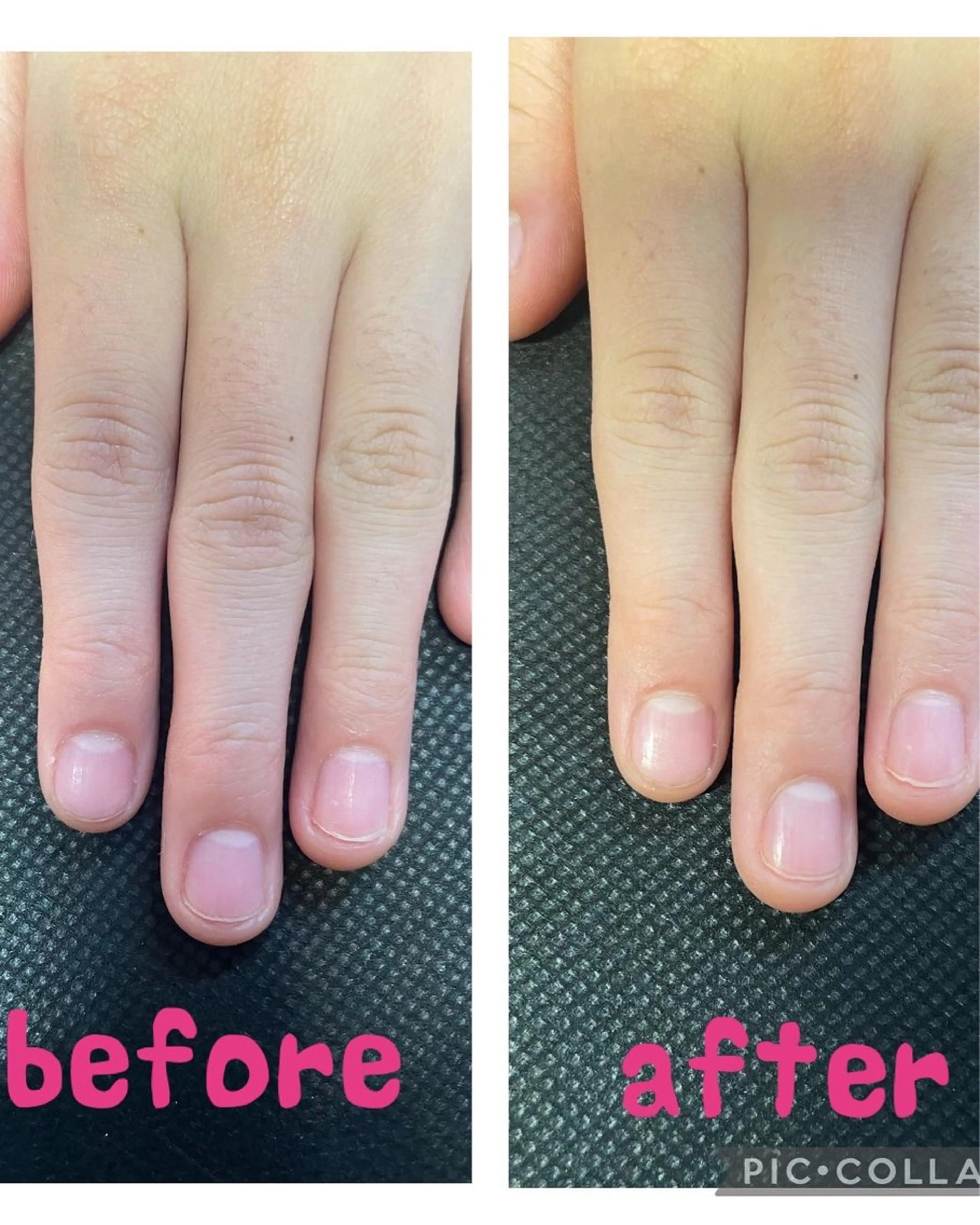 ネイル 荒井 恵のネイルデザイン