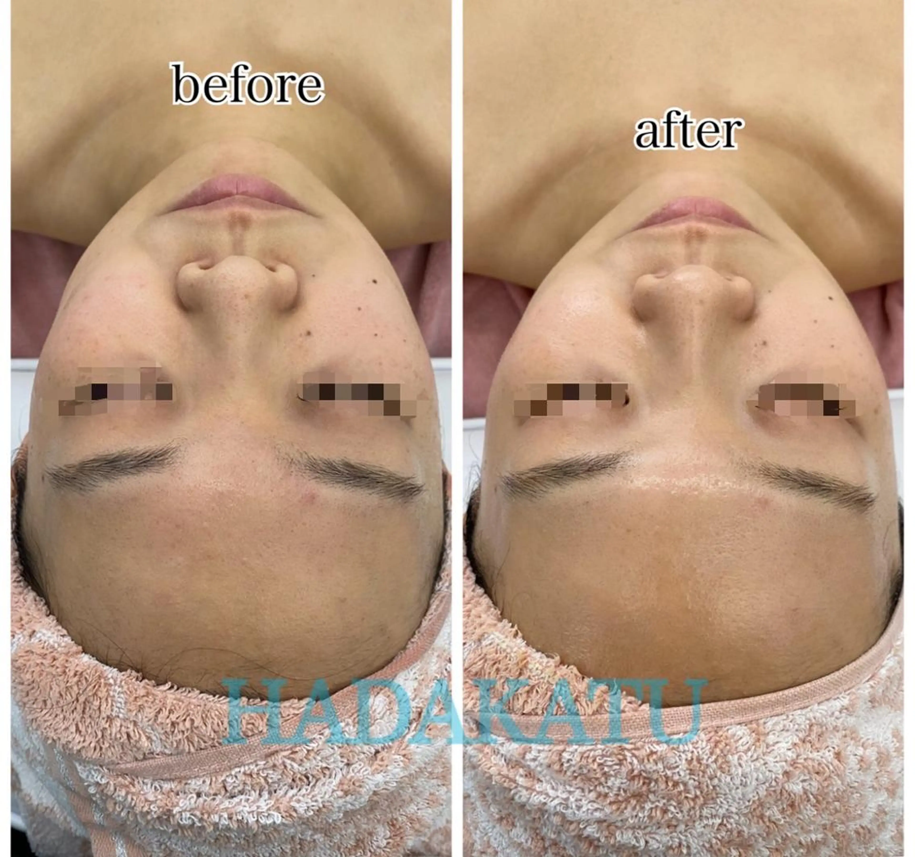 総合エステサロン 肌活のエステ・リラクイメージ