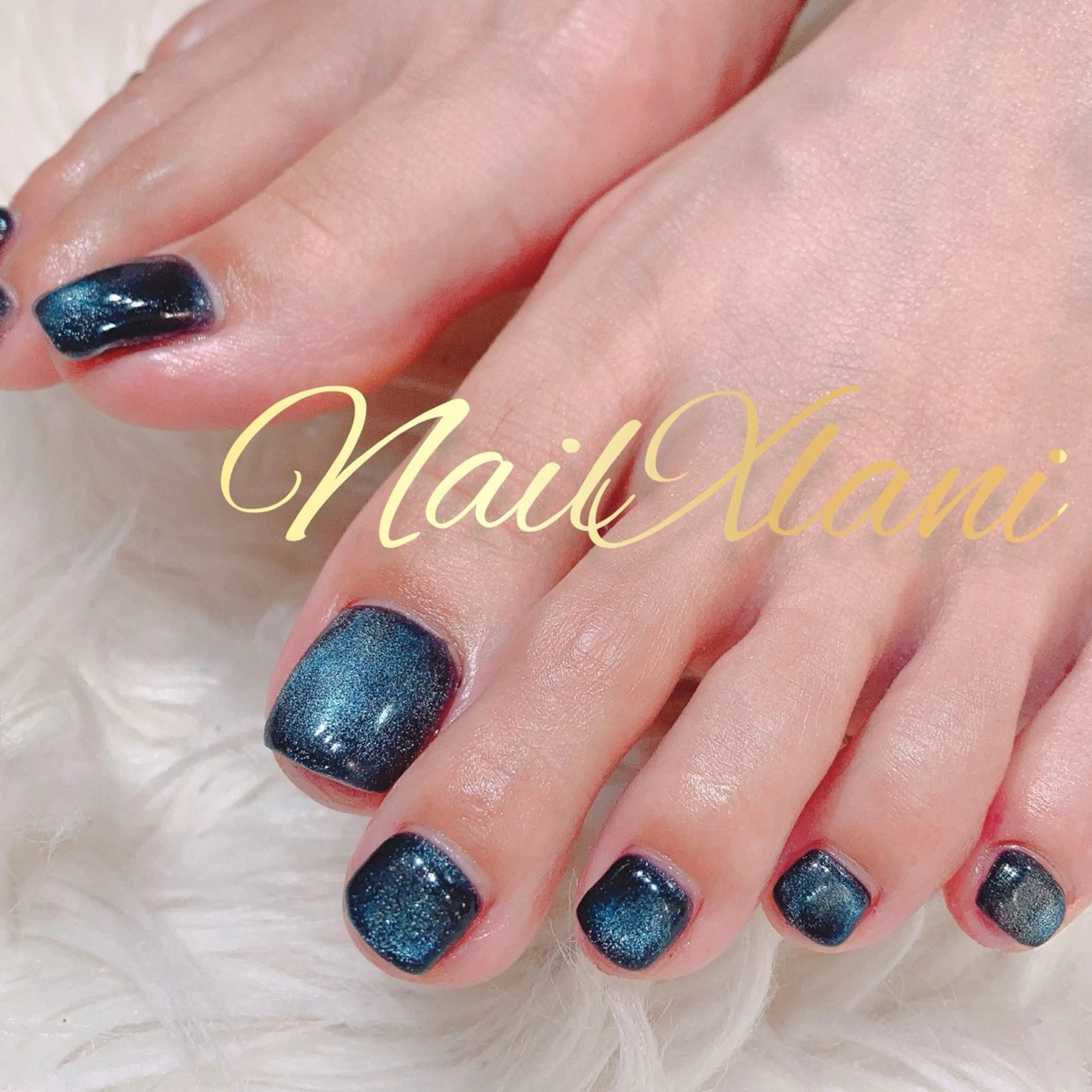 ネイル フットネイル Nail×Lani 深爪矯正対応◎のネイルデザイン