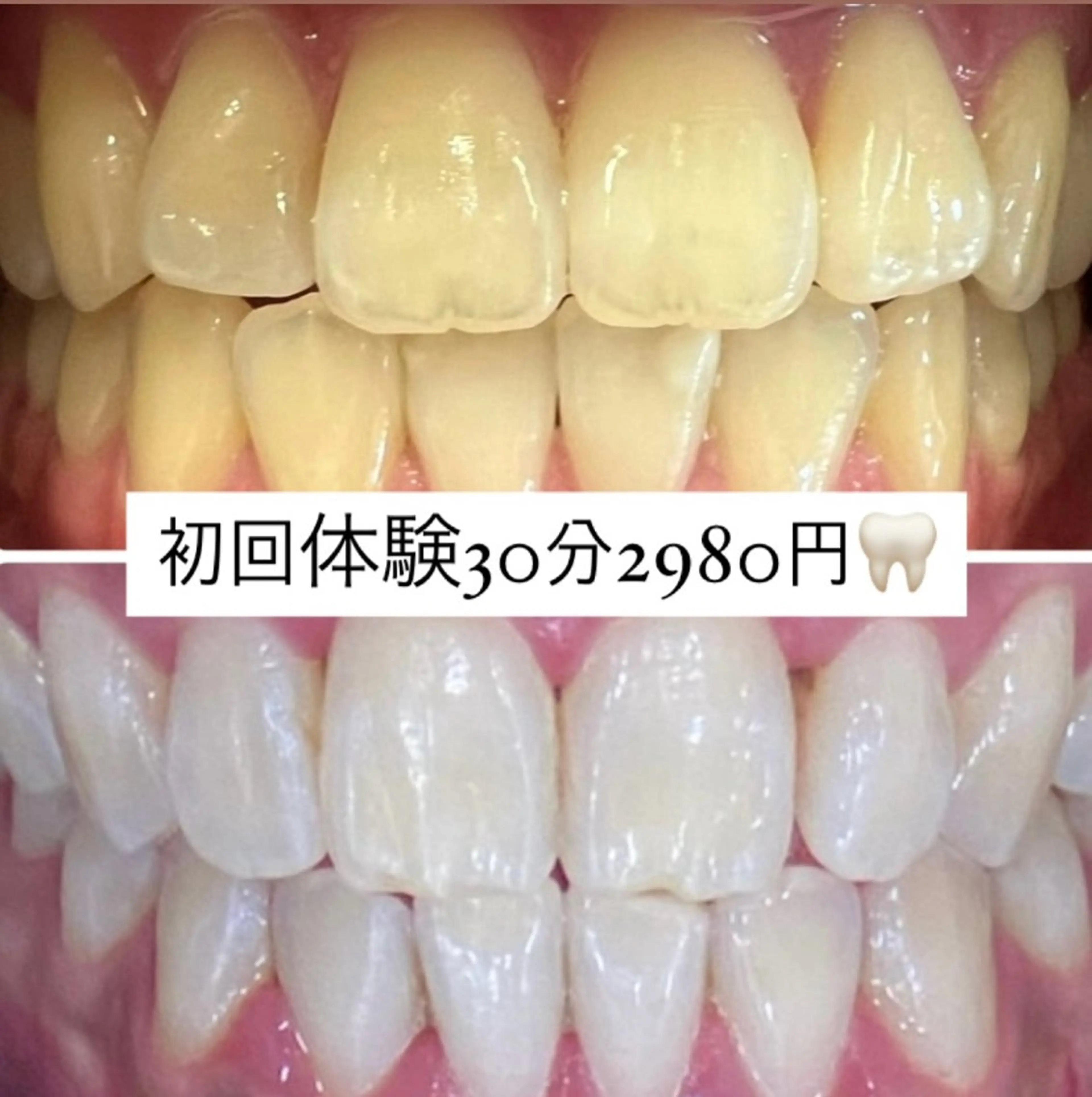 その他 ホワイトニングルーム 横浜店のその他イメージ