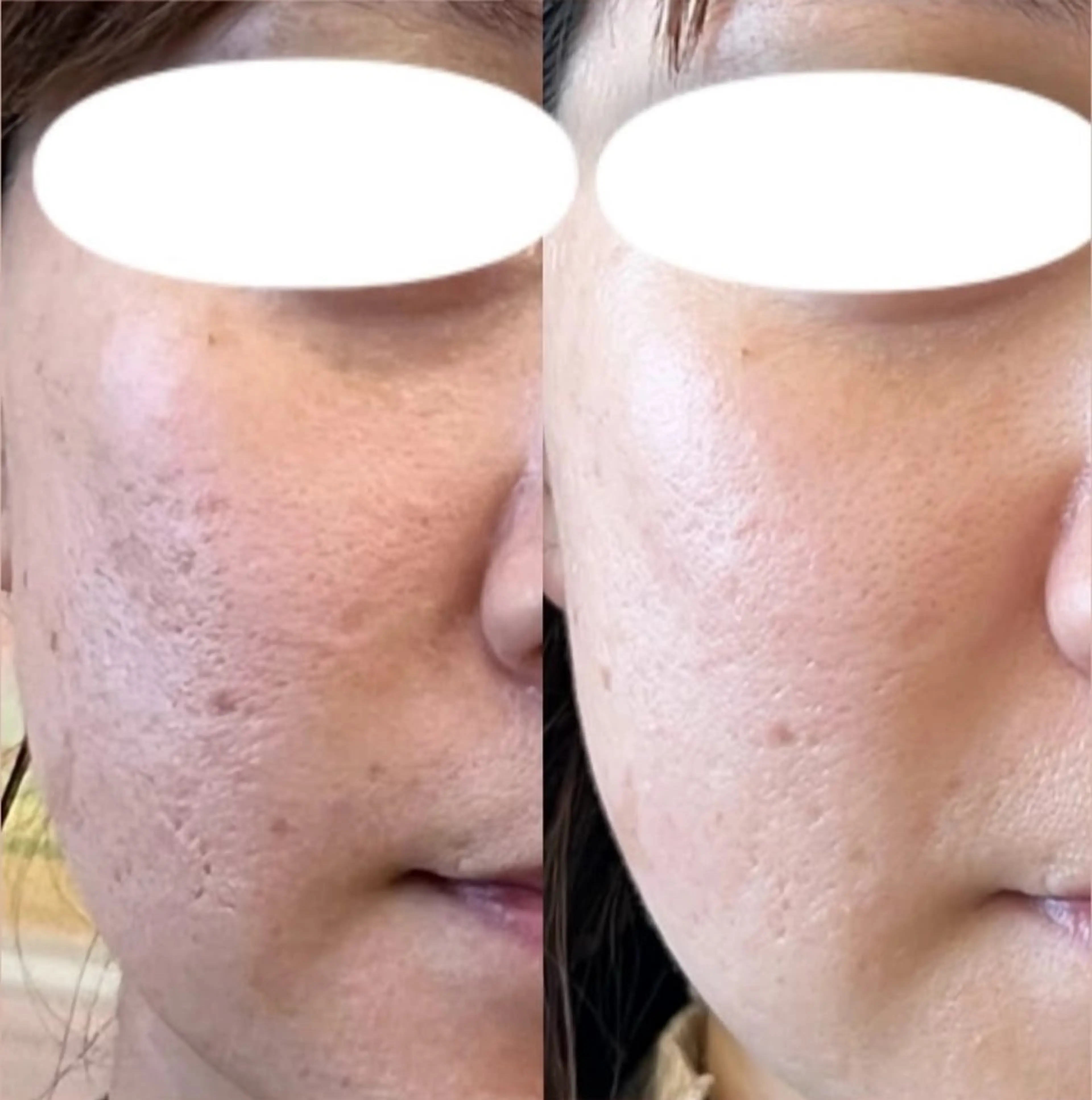 LOUISE. ／肌質・頭皮のエステ・リラクイメージ