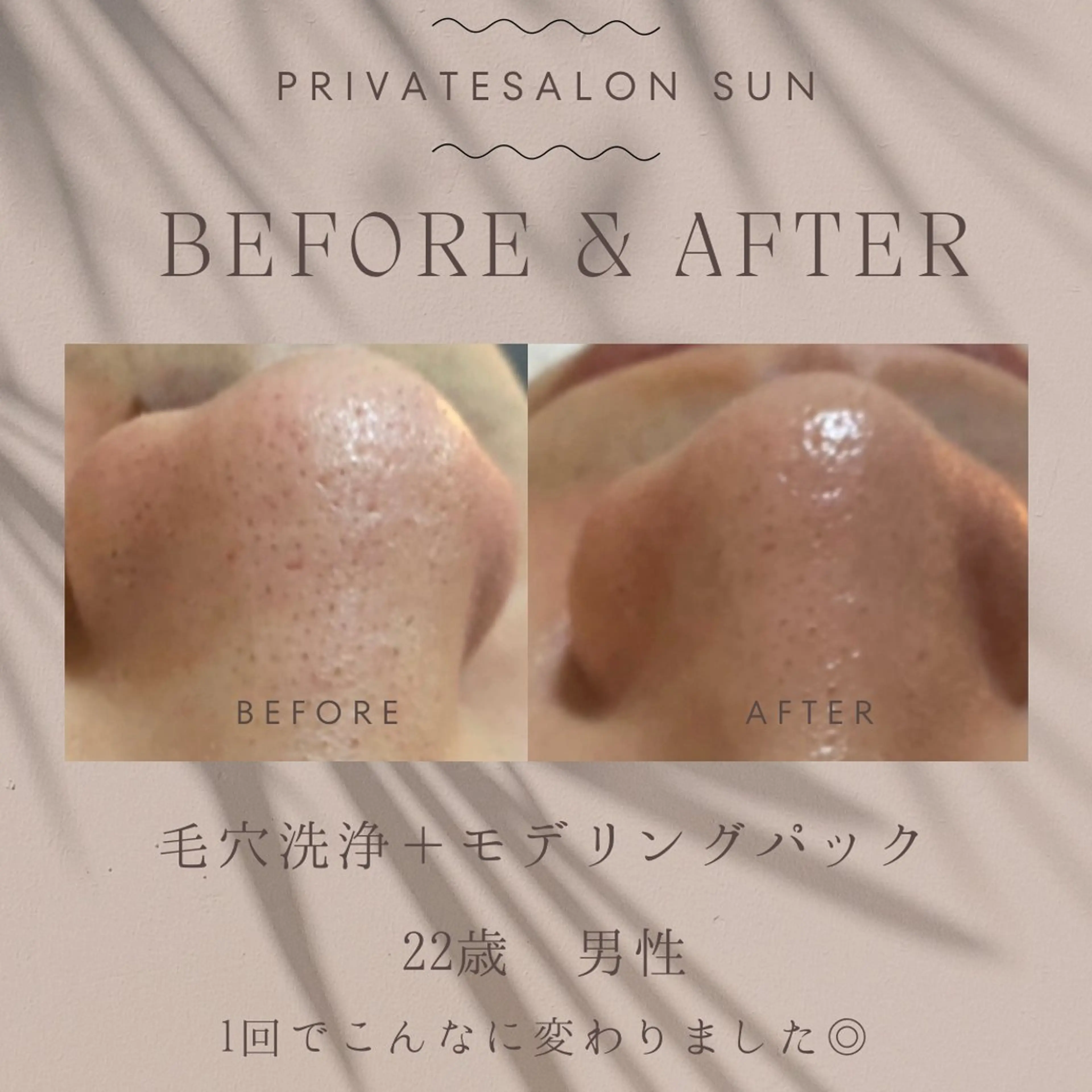 【肌質改善・腸揉み】 Nico laughのエステ・リラクイメージ