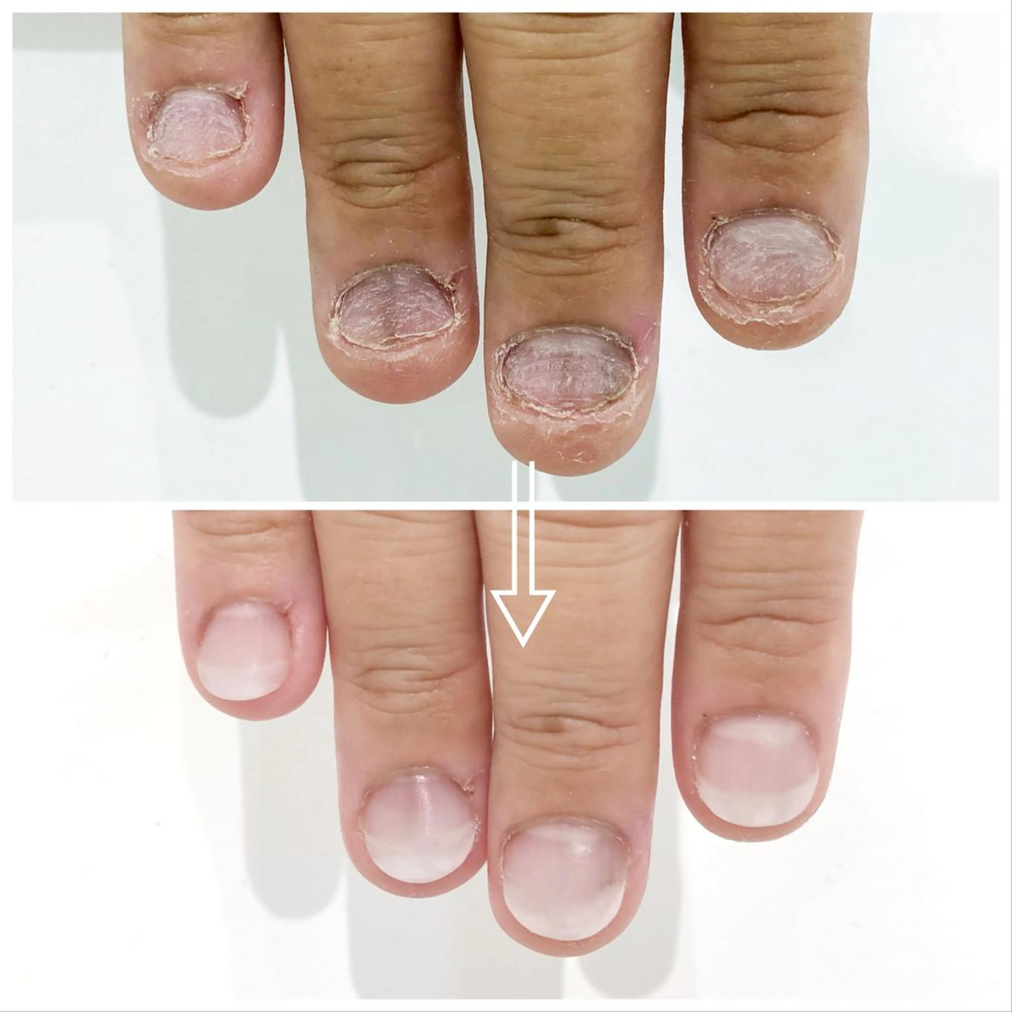 ネイル NAILSALON RuINのネイルデザイン