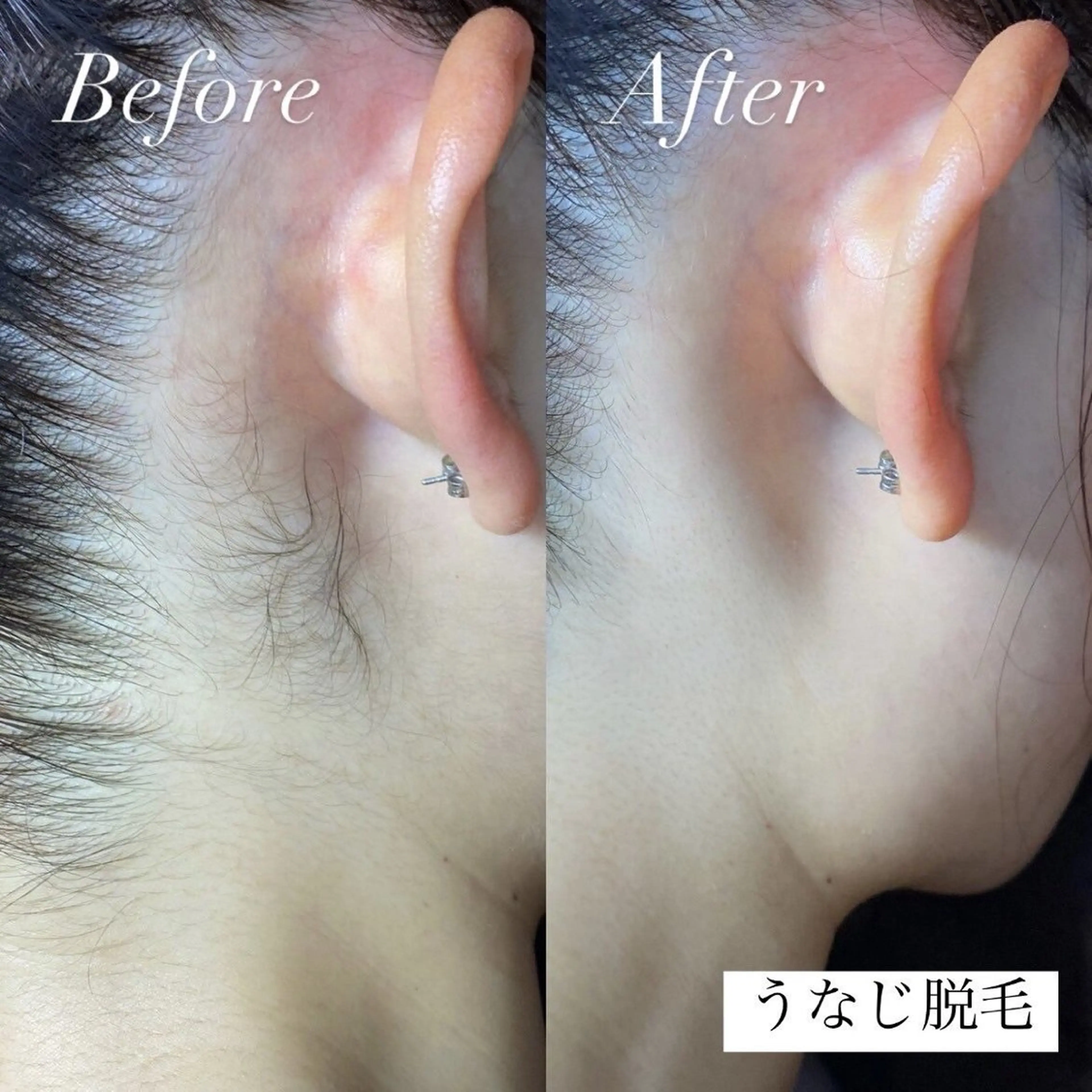 emiluca西目/ 脱毛/細胞美容のエステ・リラクイメージ