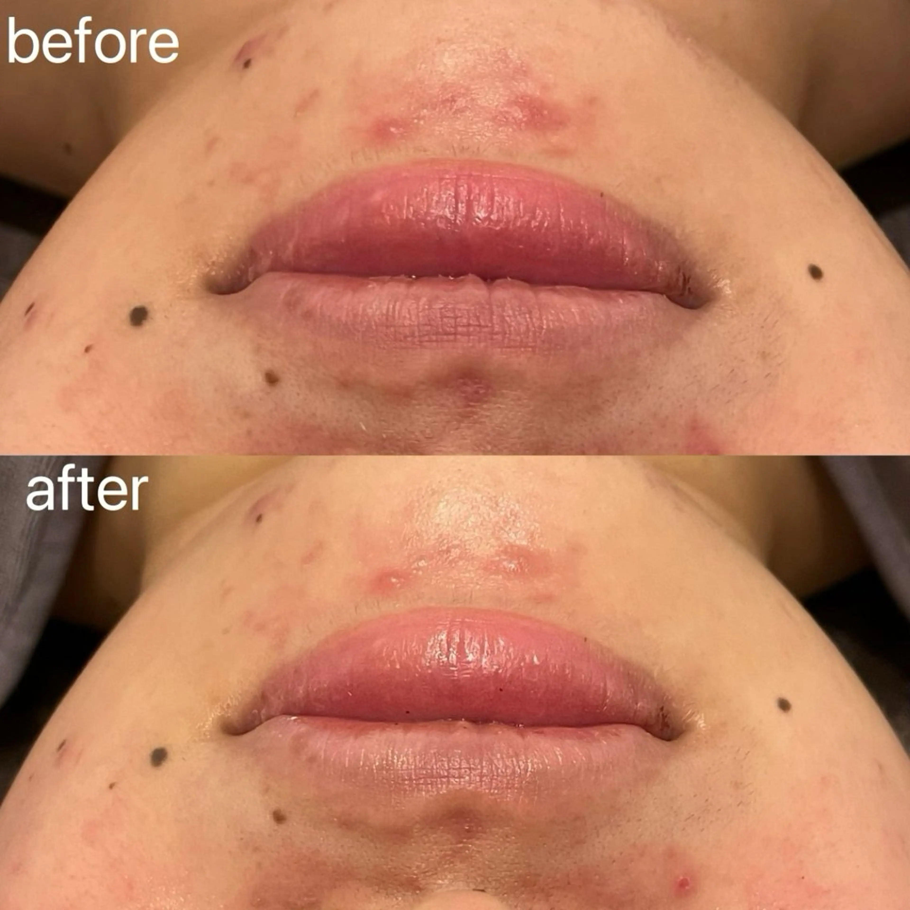 エステ 小顔＆まつ毛サロン AKANE❤️のエステ・リラクイメージ