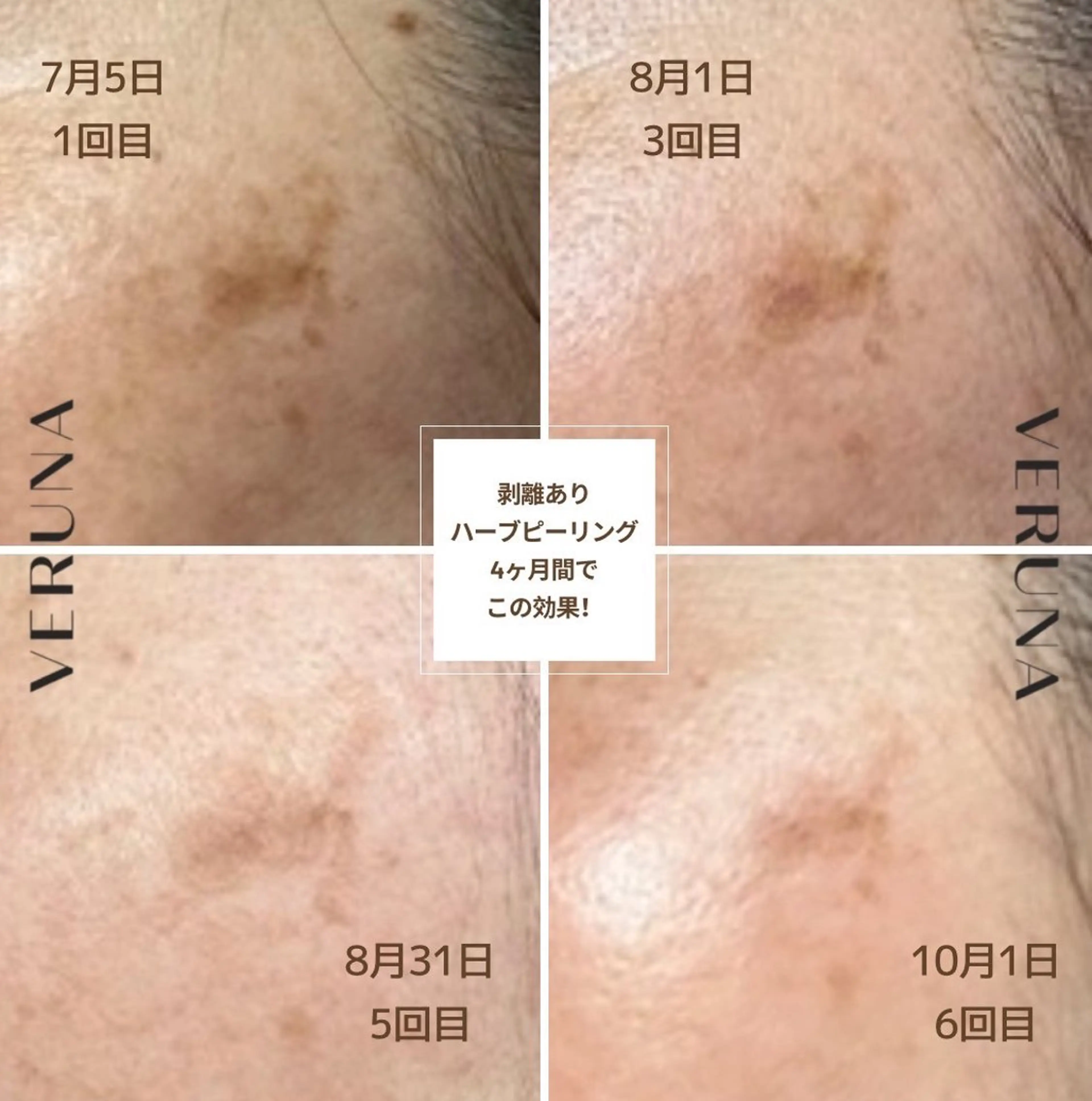 エステ 毛穴改善サロン d'Alba大阪住吉のエステ・リラクイメージ