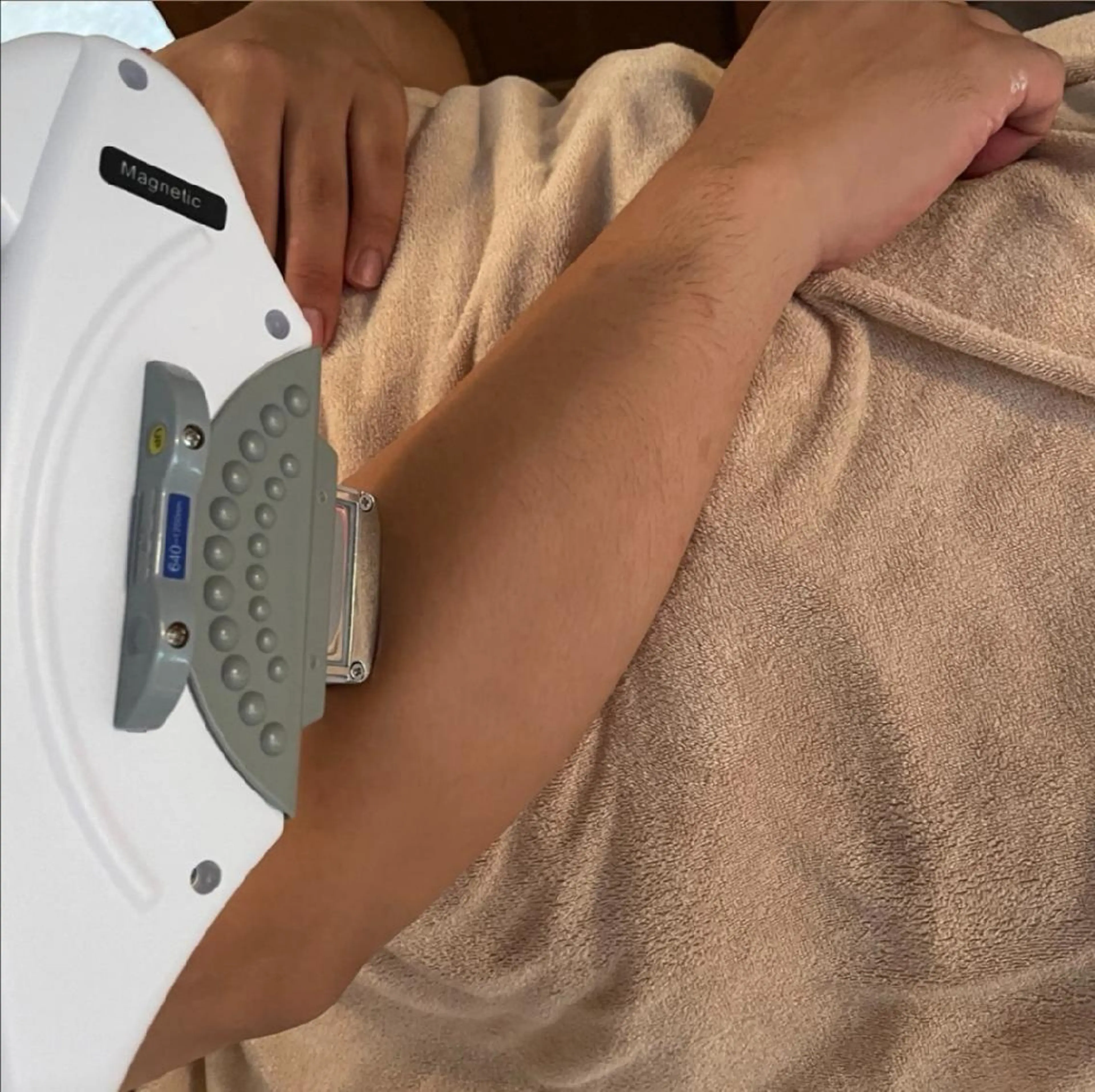 メンズお試し脱毛の写真