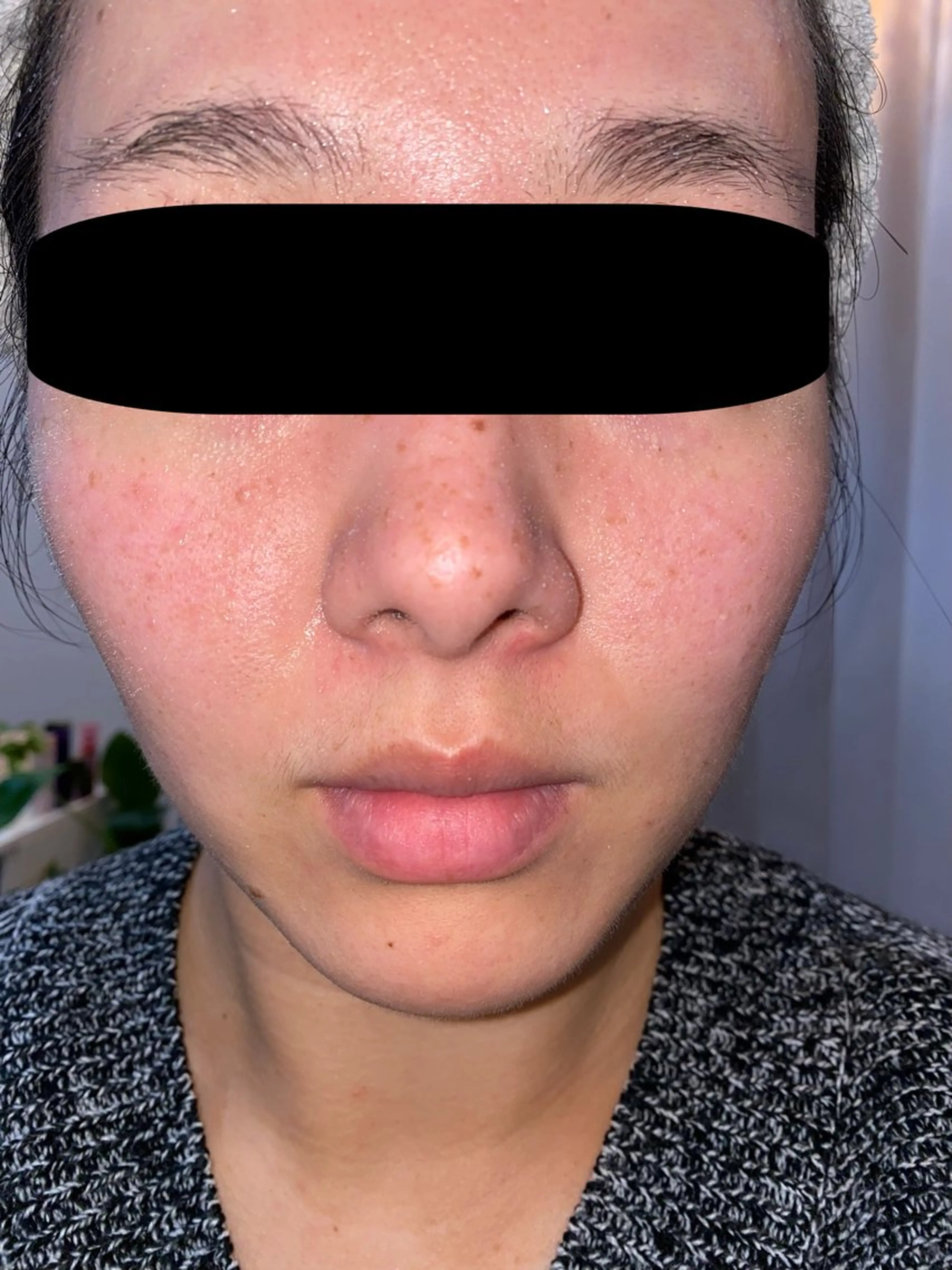 ビューティーサロン ソナタのエステ・リラクイメージ