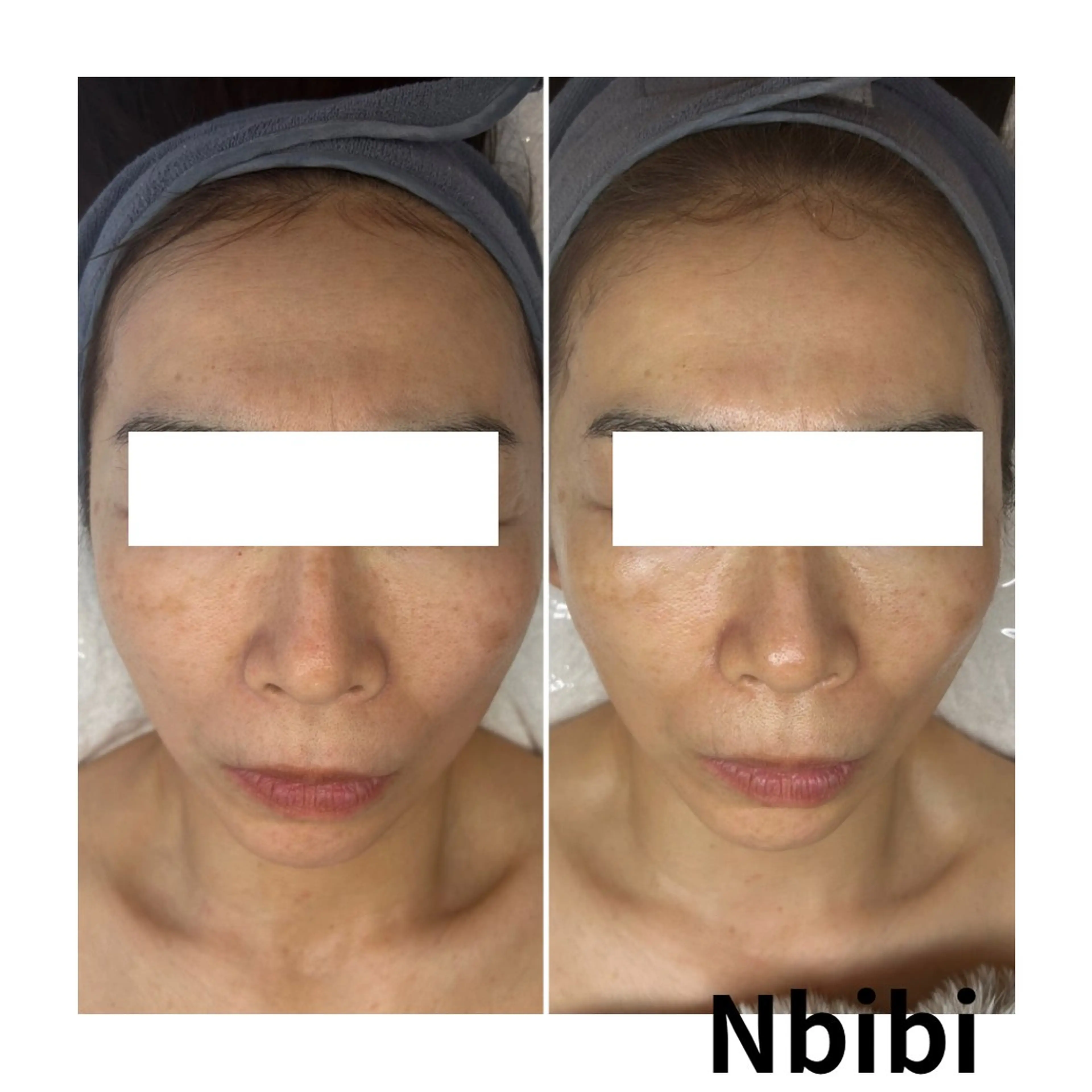 エステ 韓国🇰🇷価格 サロン_Nbibiの眉毛・アイブロウイメージ