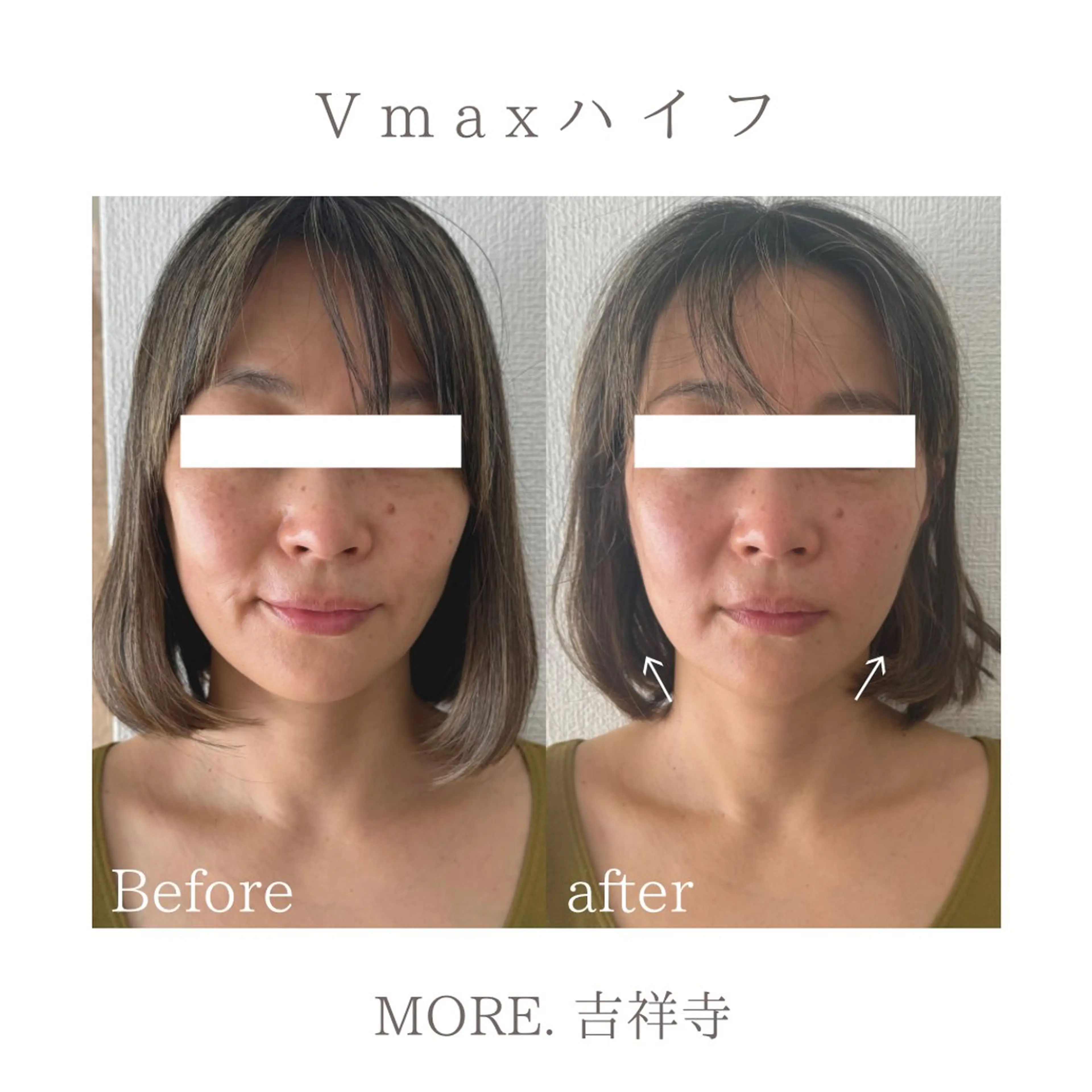 MORE. NEMAのエステ・リラクイメージ