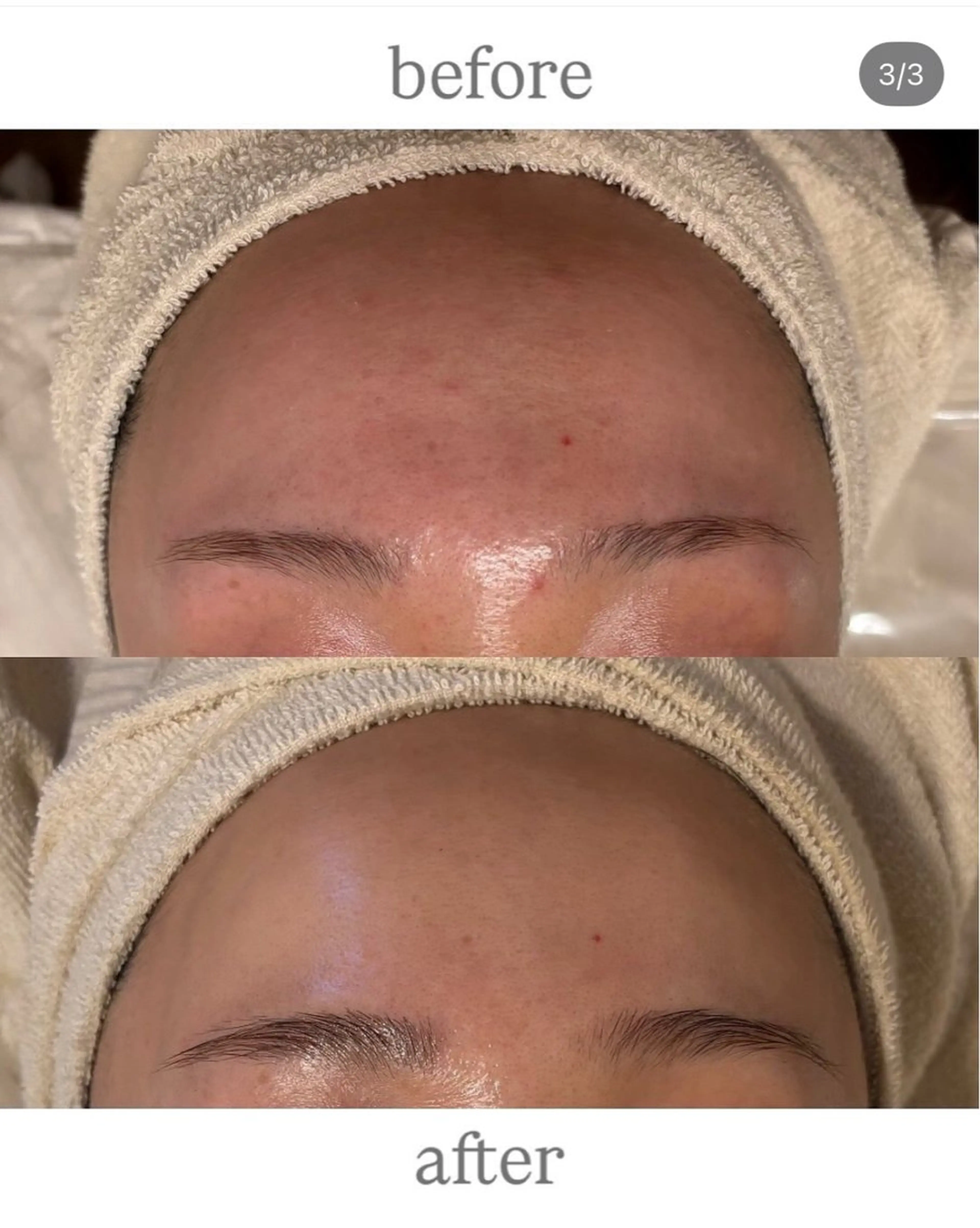 エステ anthes /MIHOのエステ・リラクイメージ