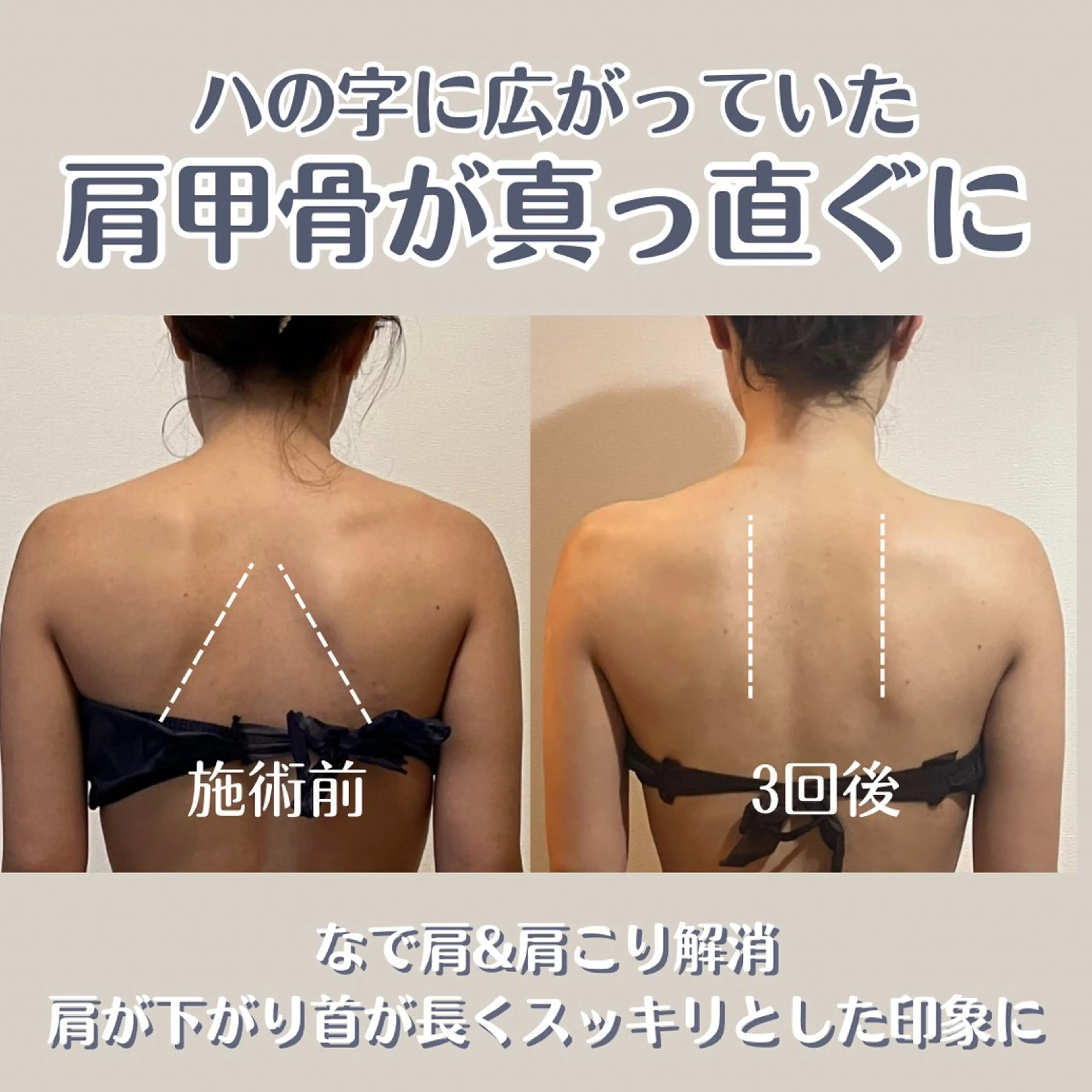 小顔矯正/骨格矯正 AKANEのエステ・リラクイメージ