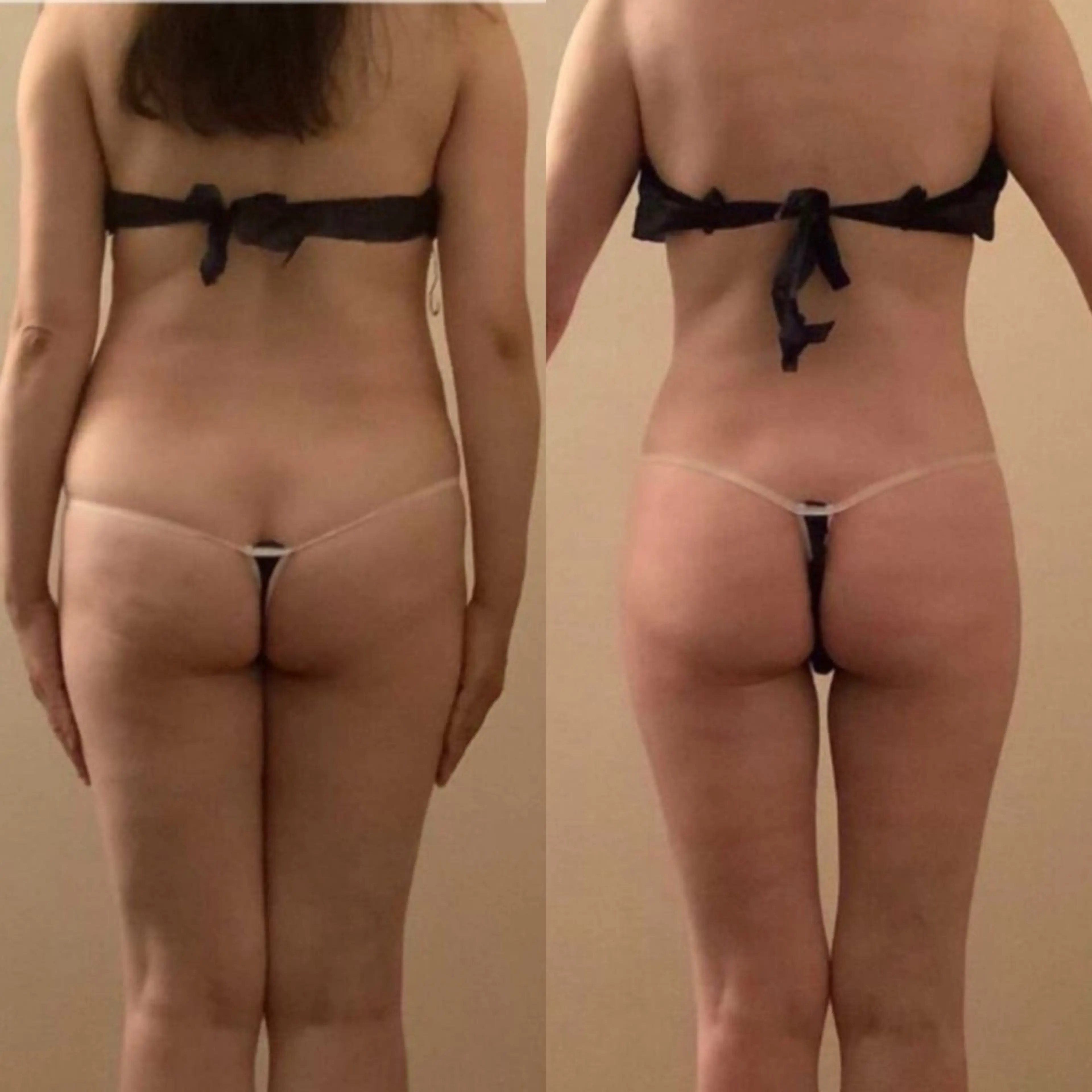 エステ 🦋痩身専門サロン Re:oasis🦋のエステ・リラクイメージ