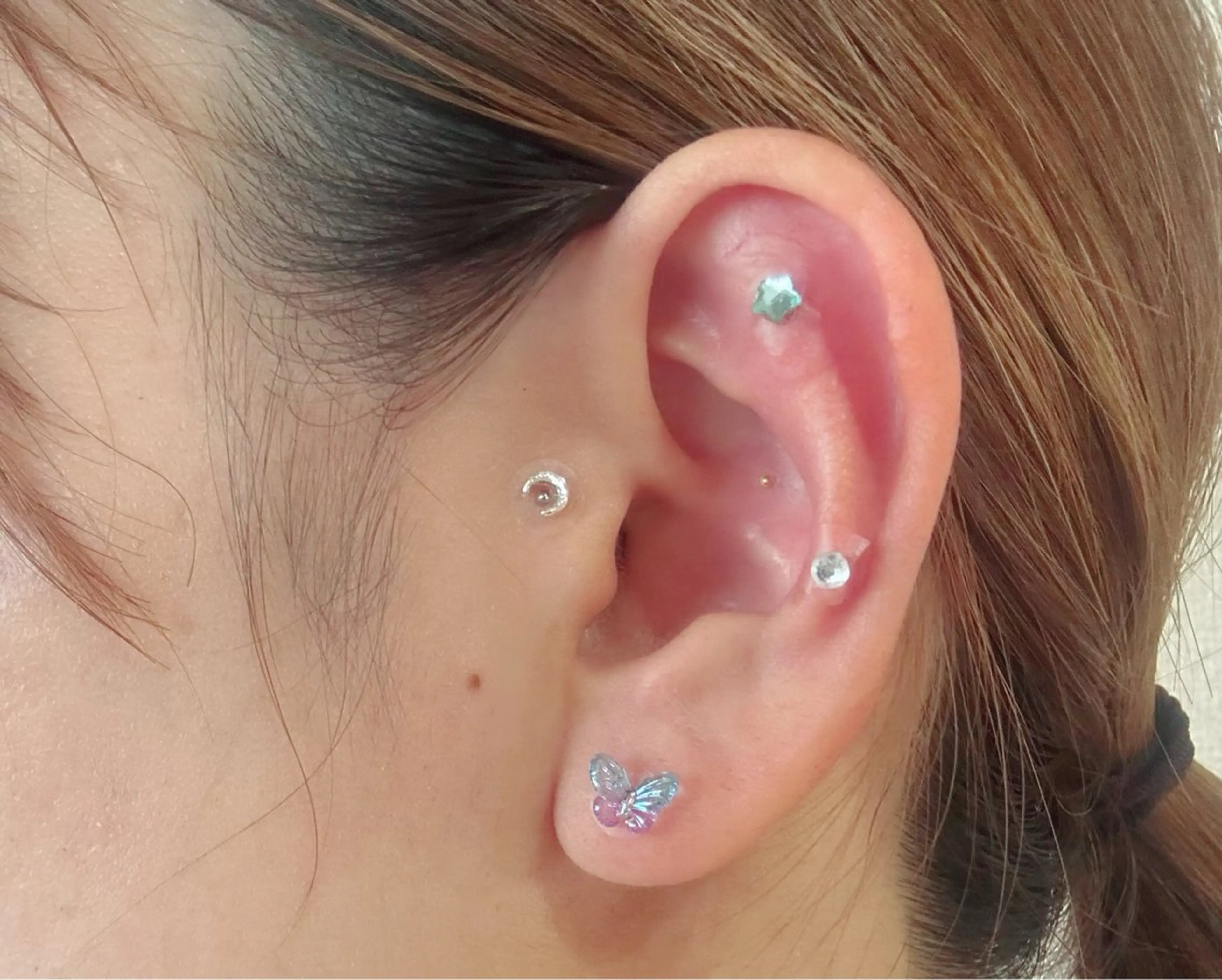 脱毛・ホワイトニング 耳ツボ・美白・毛穴のその他イメージ