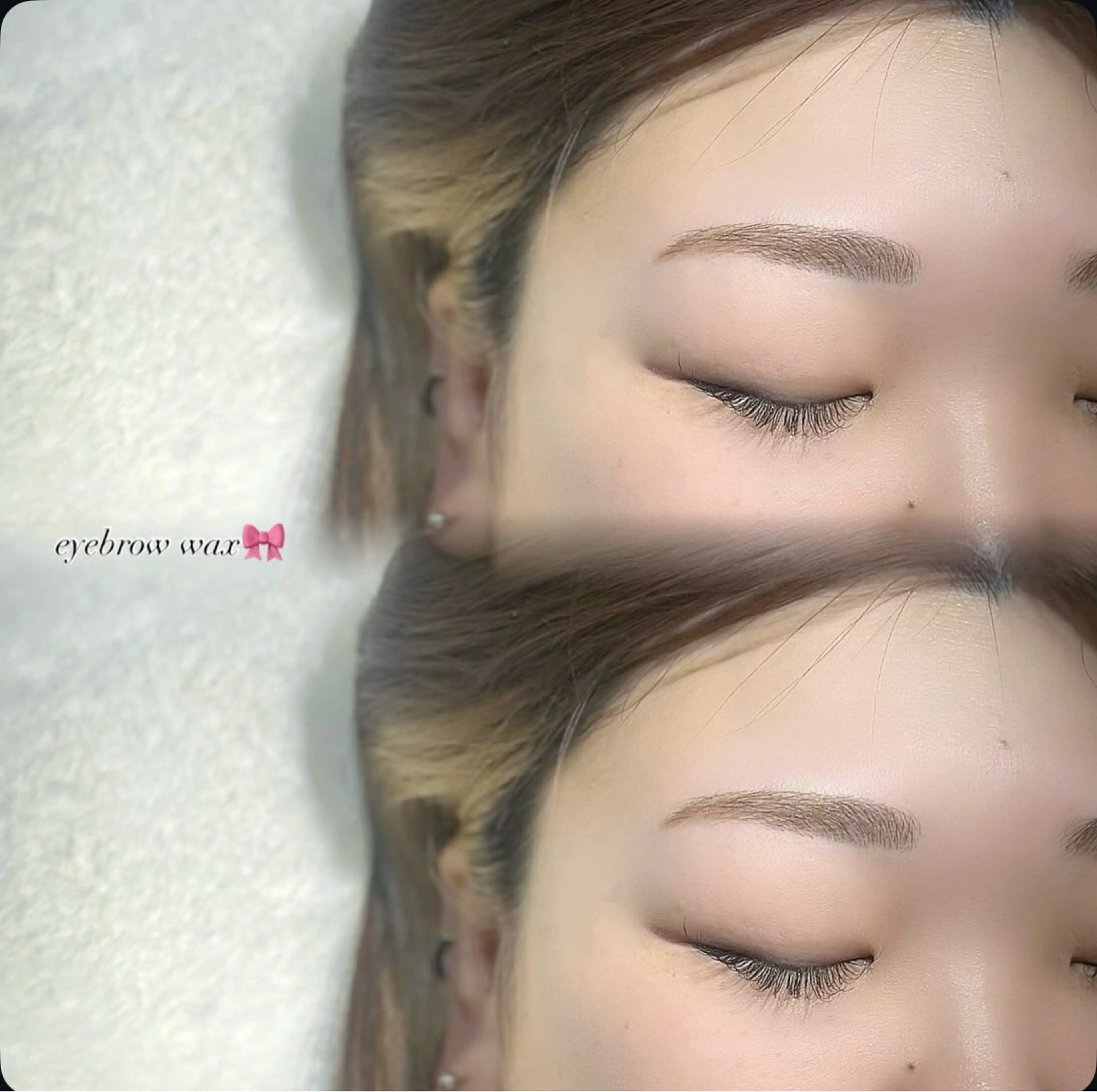 ワックス脱毛の写真