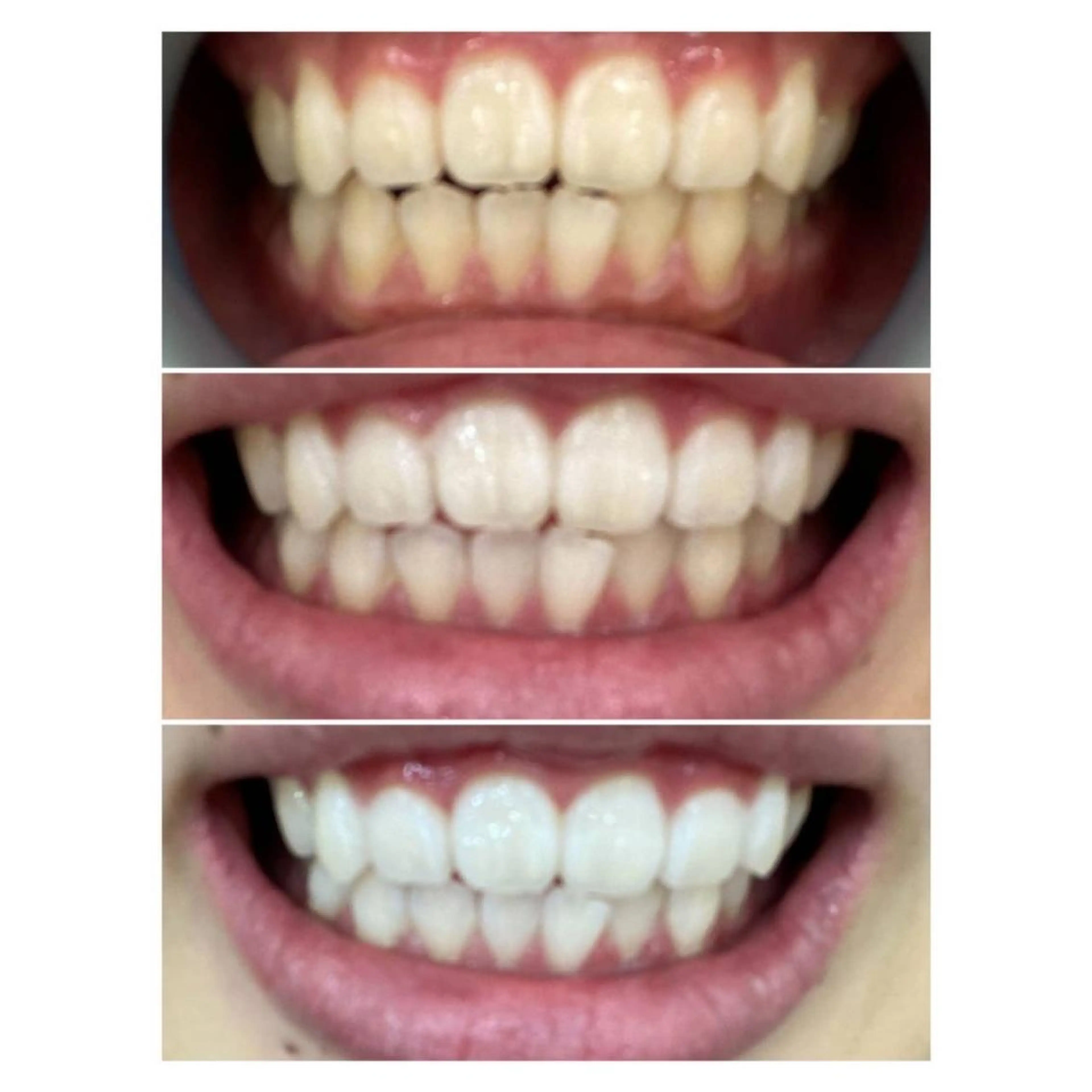 MBEAUTYSALON 千葉店・京成大久保所属・Melty 輝のその他イメージ