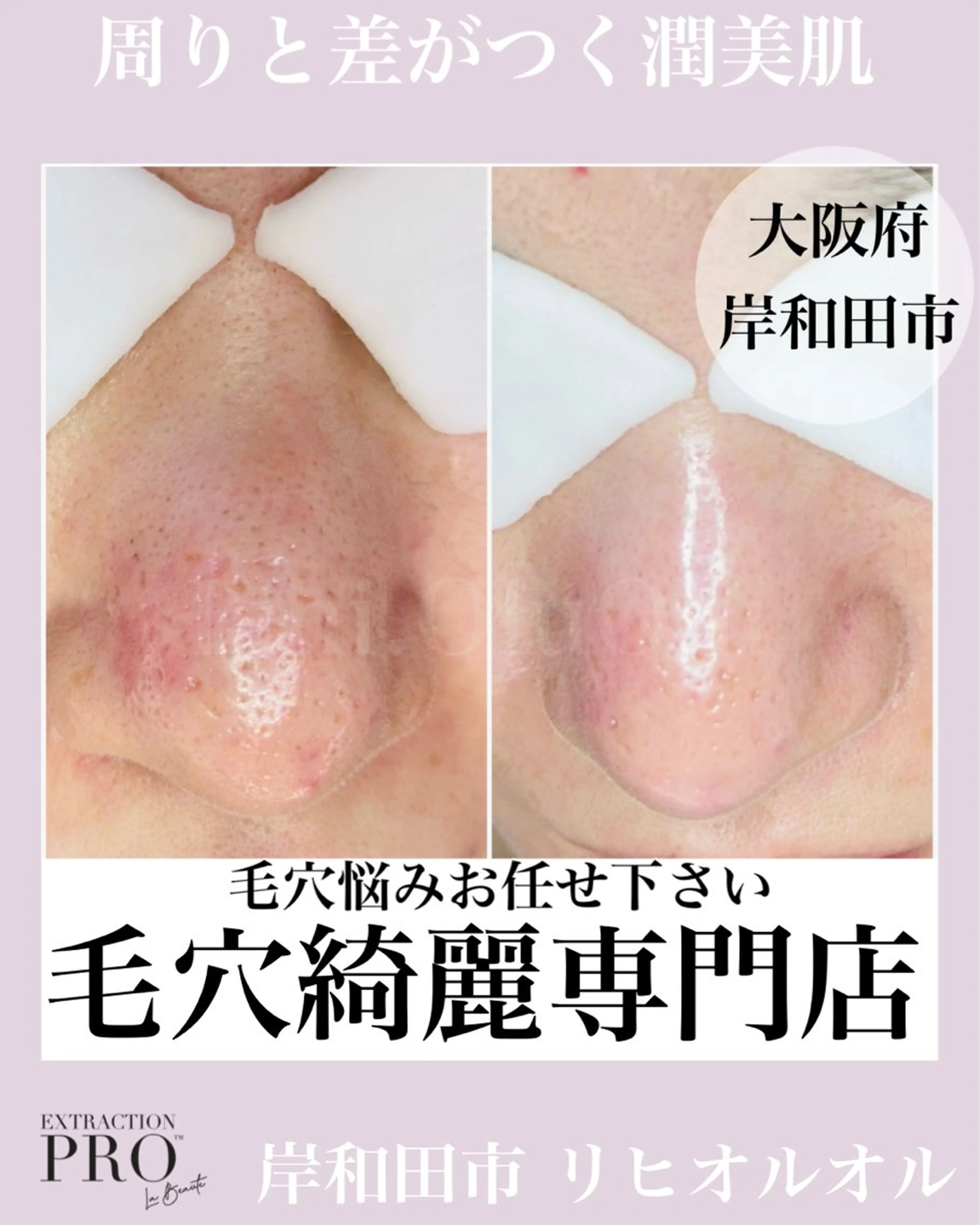 毛穴汚れ改善専門店/ 岸和田/リヒオルオルのエステ・リラクイメージ