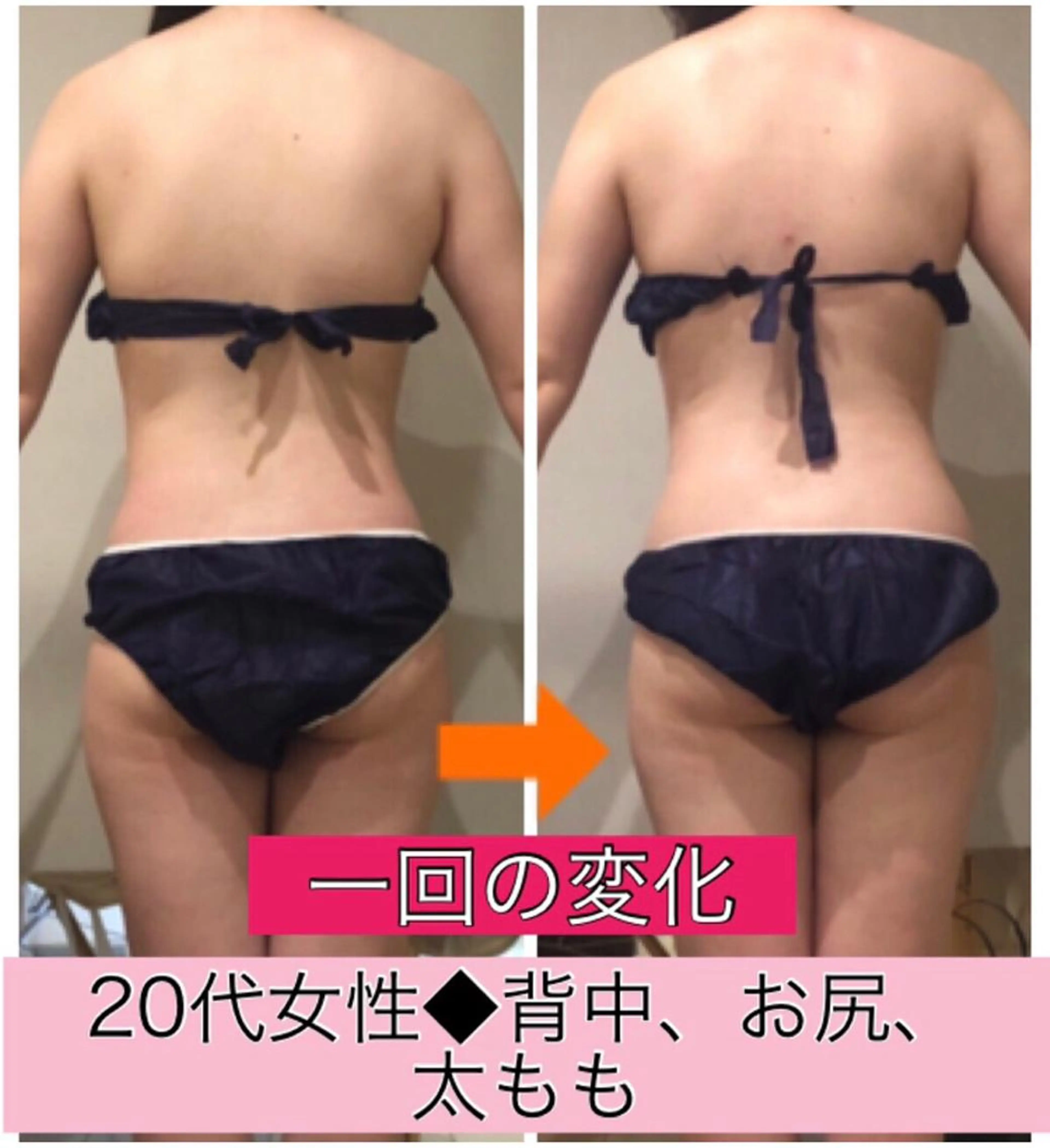 ショート カラー パーマ ヘアアレンジ メンズ キッズ ネイル マツエク・マツパ ‍痩身＆ボディ 結果出し🌟丹野のエステ・リラクイメージ