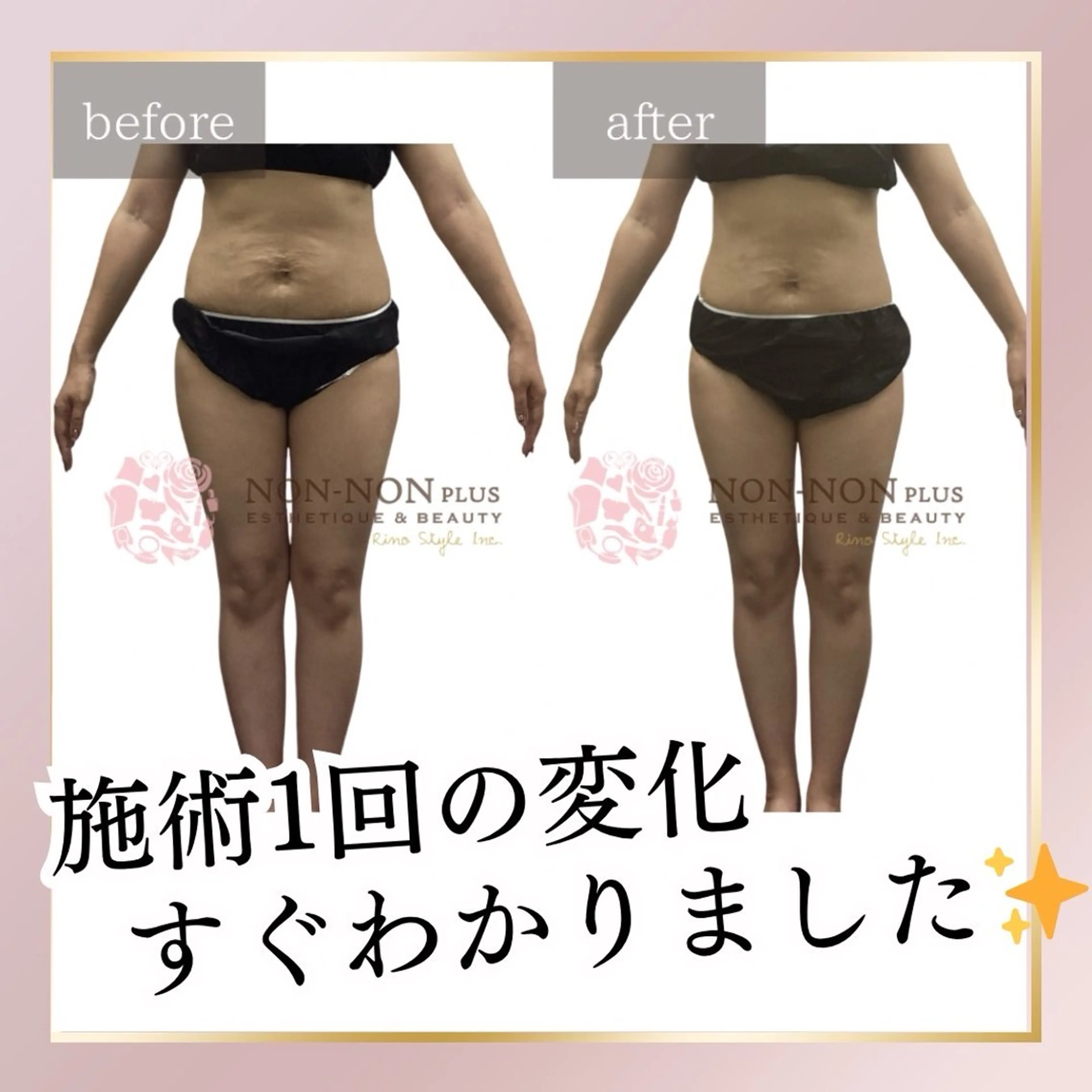 エステ リラク NON-NONプラス 大人の本気痩身のエステ・リラクイメージ