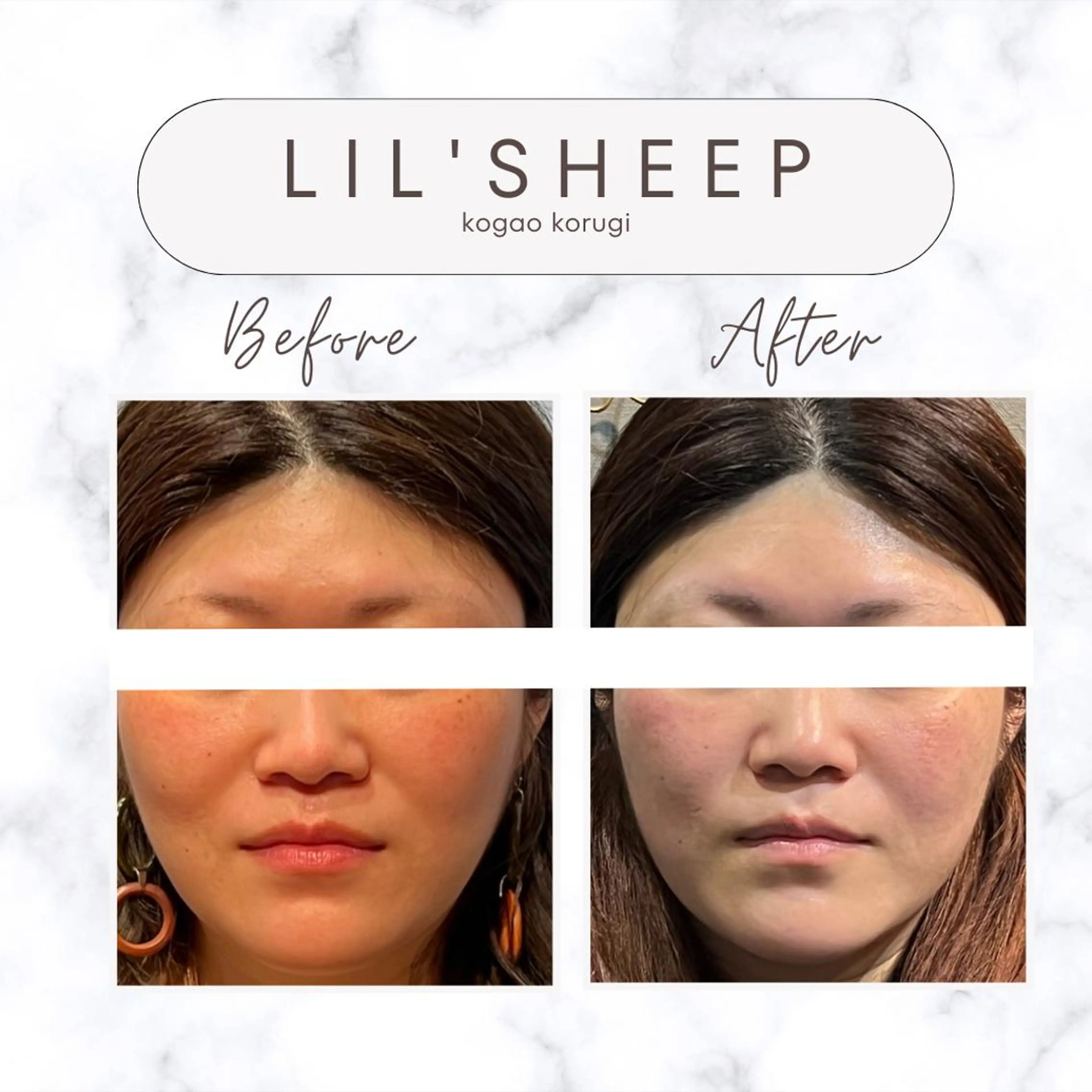 小嶋萌 今池駅徒歩2分のエステ・リラクイメージ