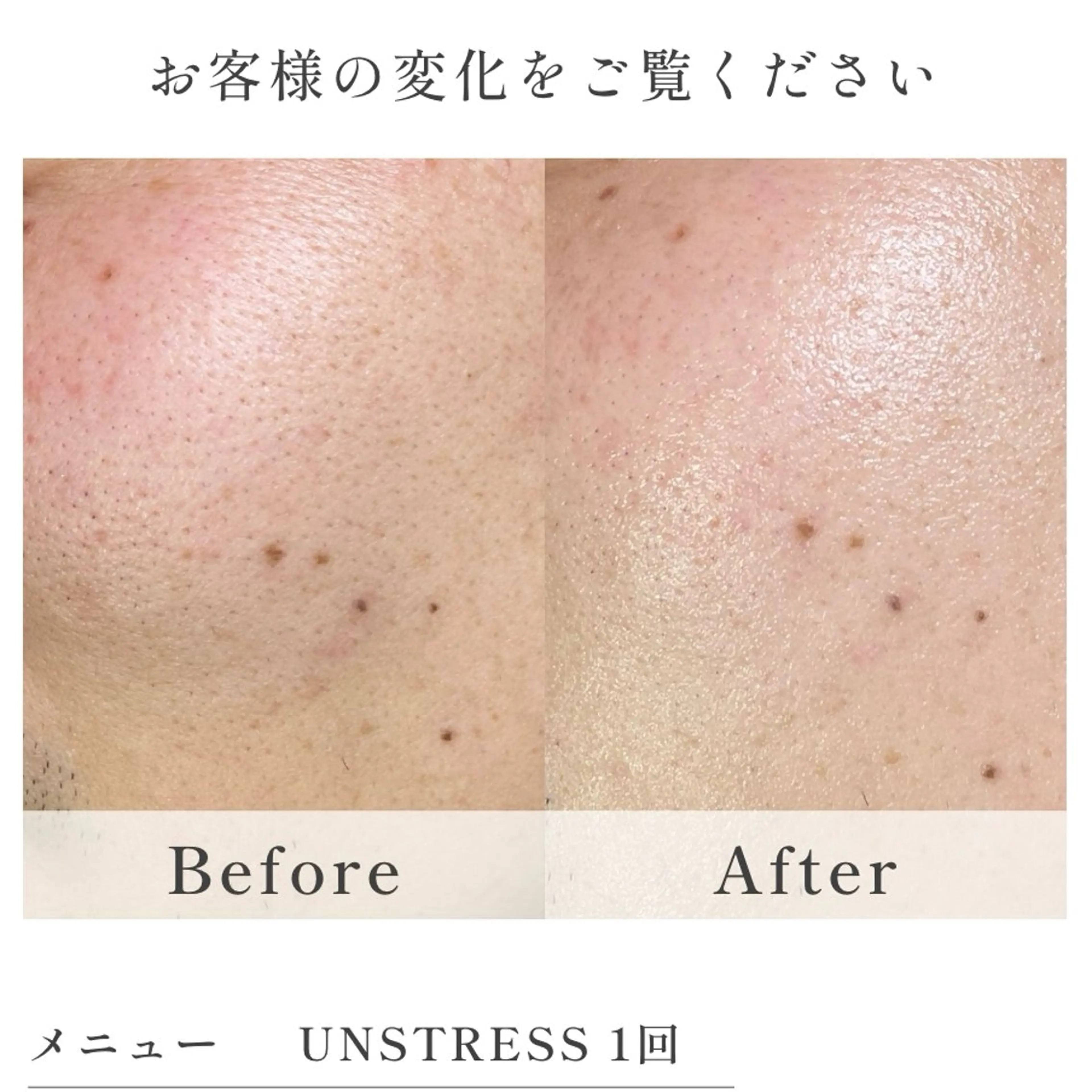 中村 萌々のエステ・リラクイメージ