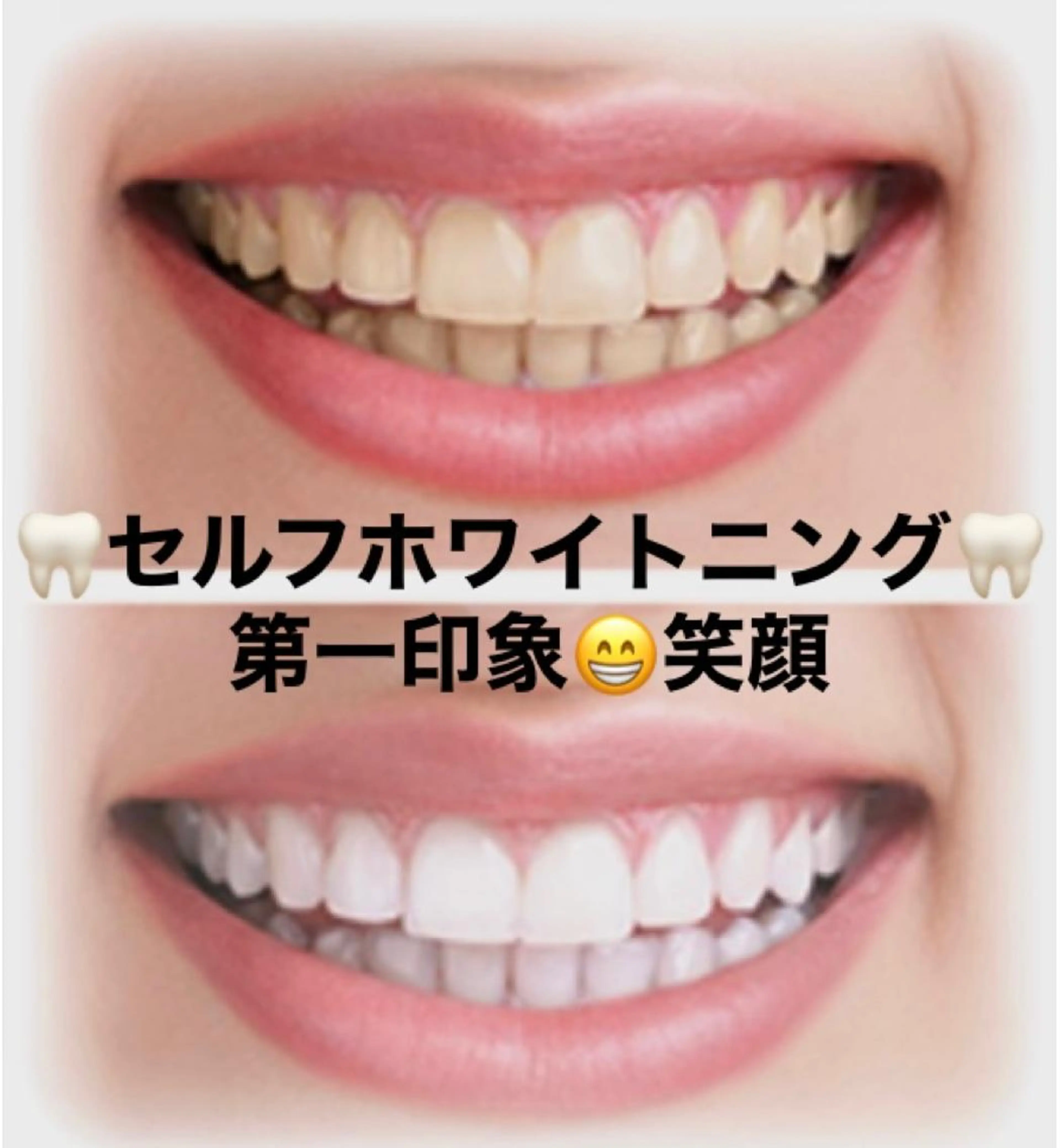 🦷10分照射✖️2回を3回分‼️初回来店日から2ヶ月有効!¥26,400→¥9,900の写真