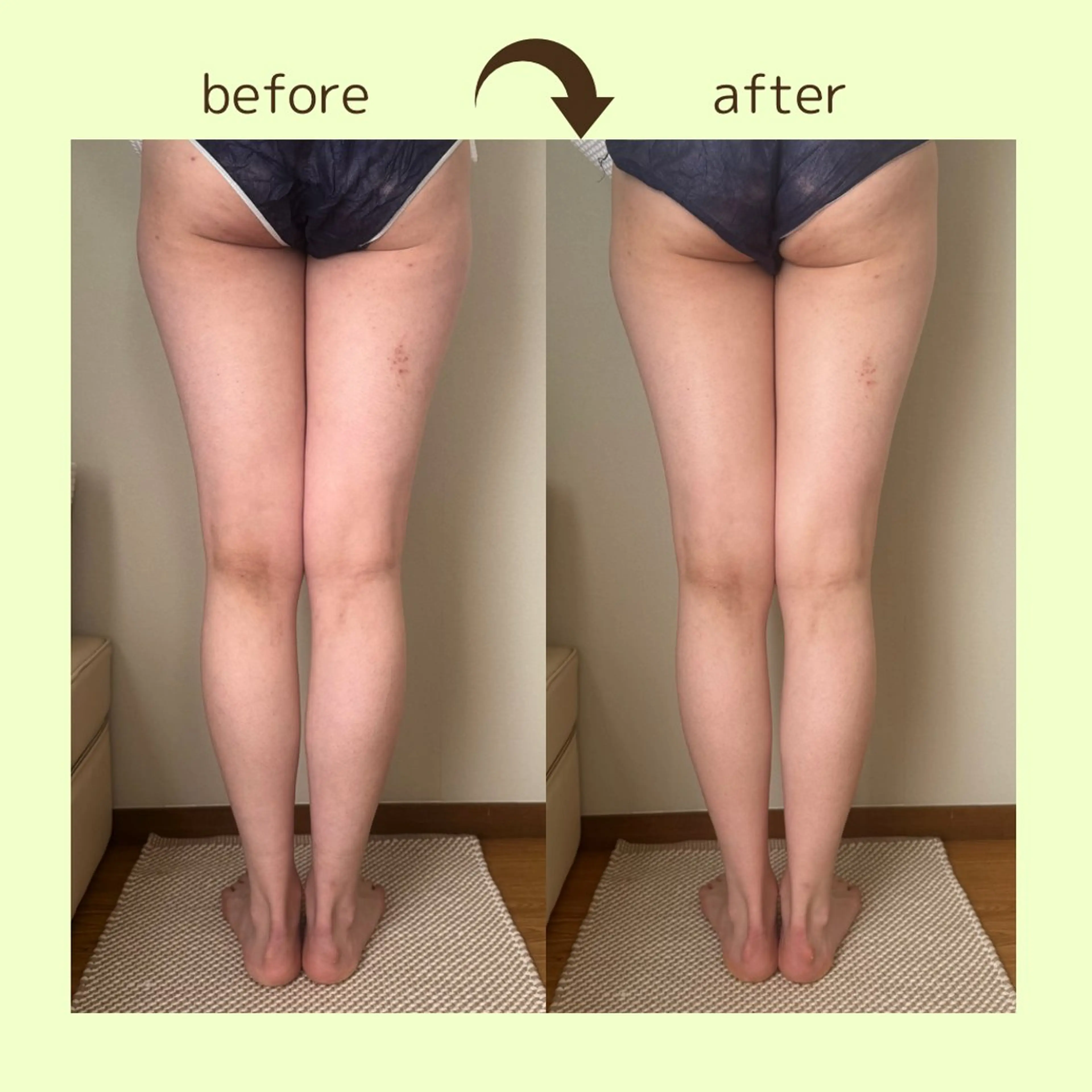 リラクゼーションスパ　ひのき所属・spaHINOKI 【女性専用】のエステ・リラクイメージ