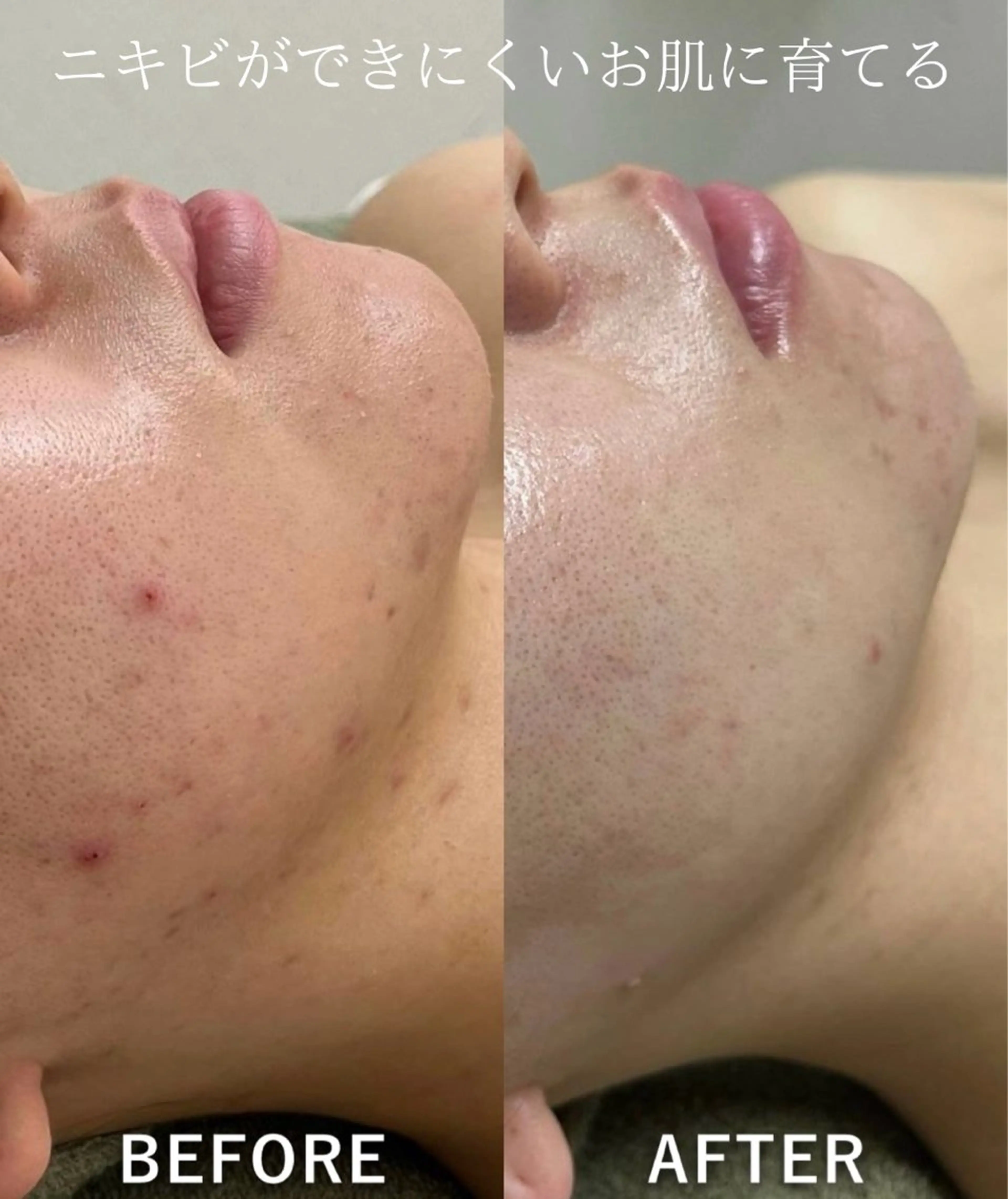 エステ 韓国美肌/肌質改善 【天神】のエステ・リラクイメージ