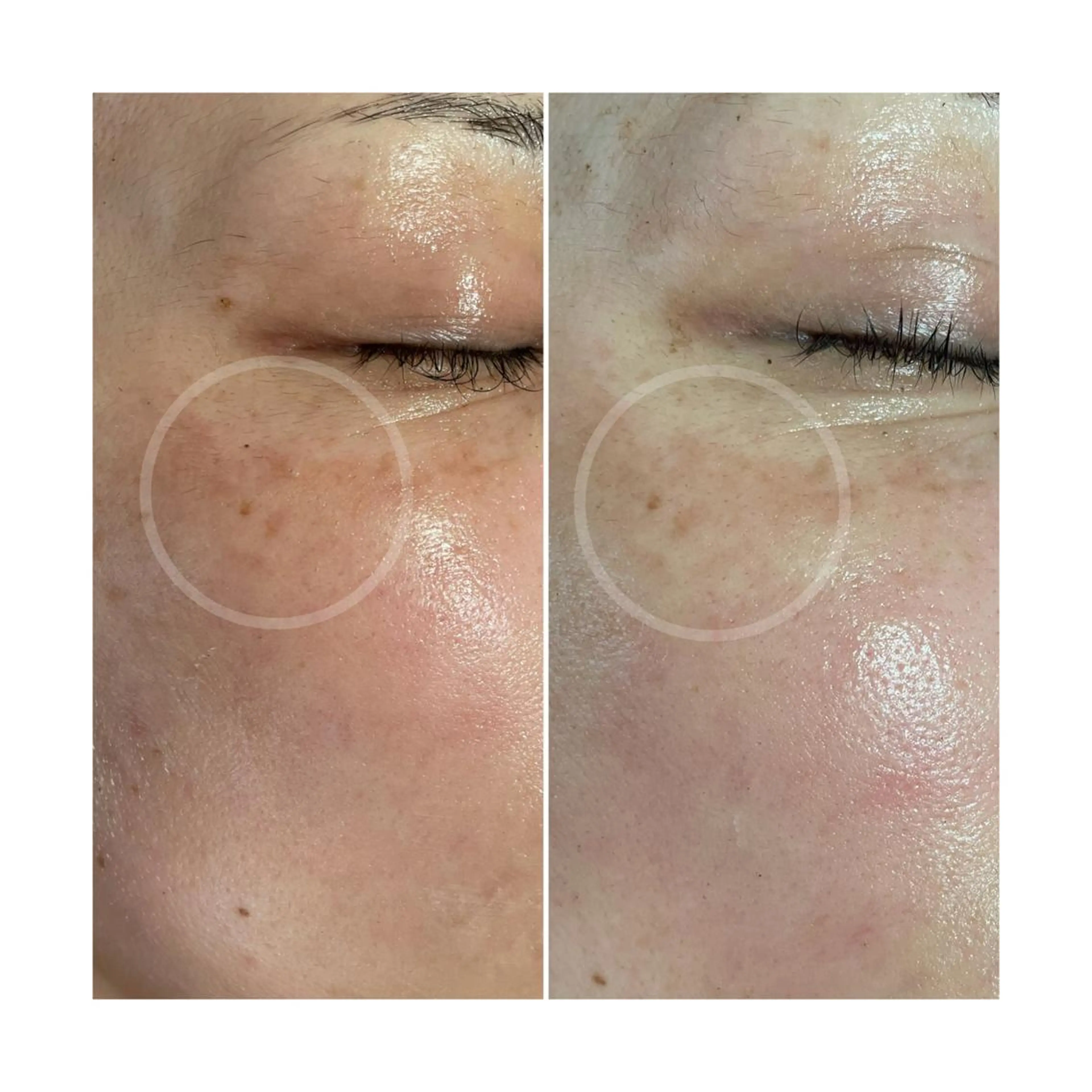 その他 大久保 里奈のエステ・リラクイメージ