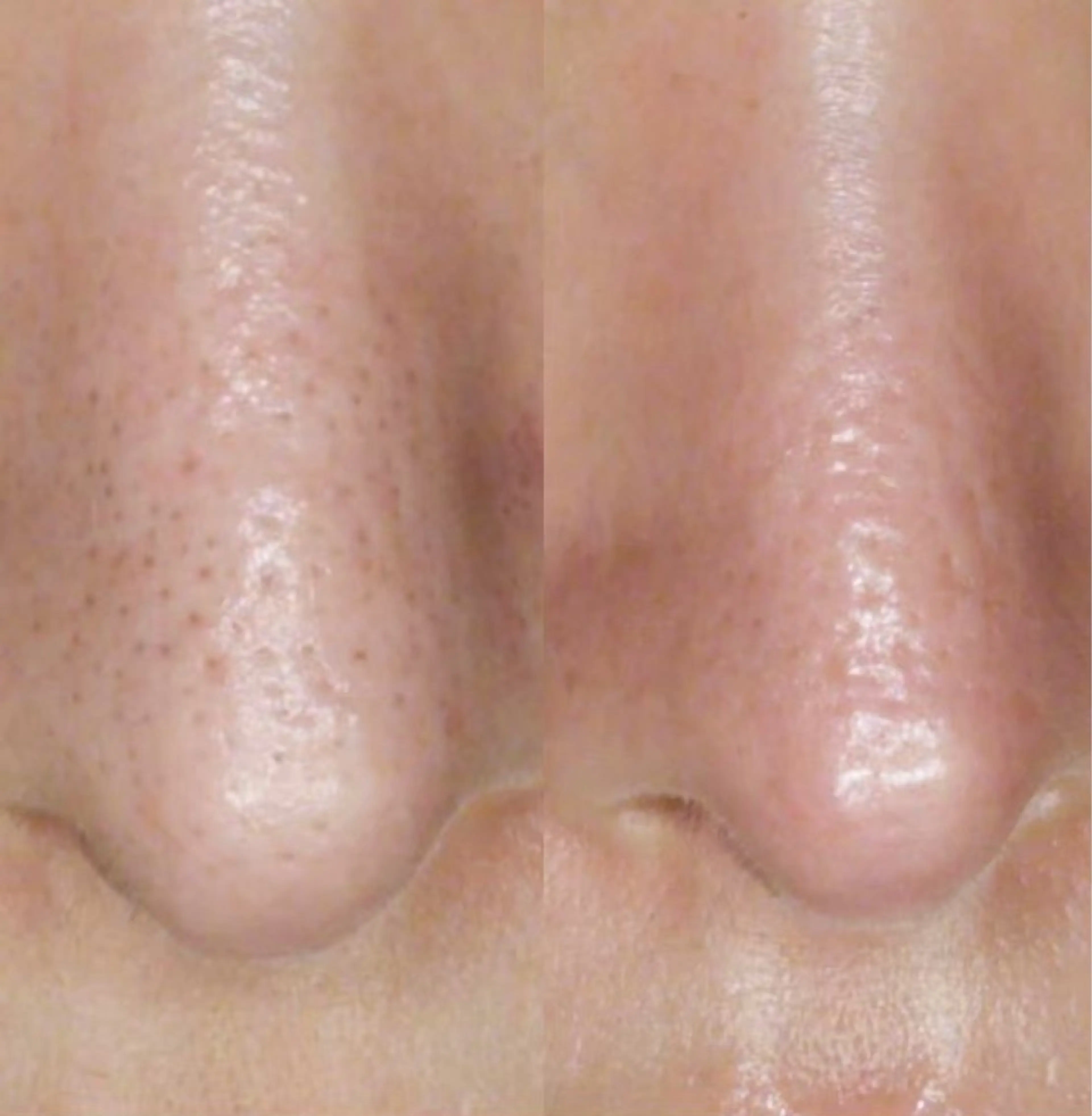 エステ 石川 彩花のエステ・リラクイメージ