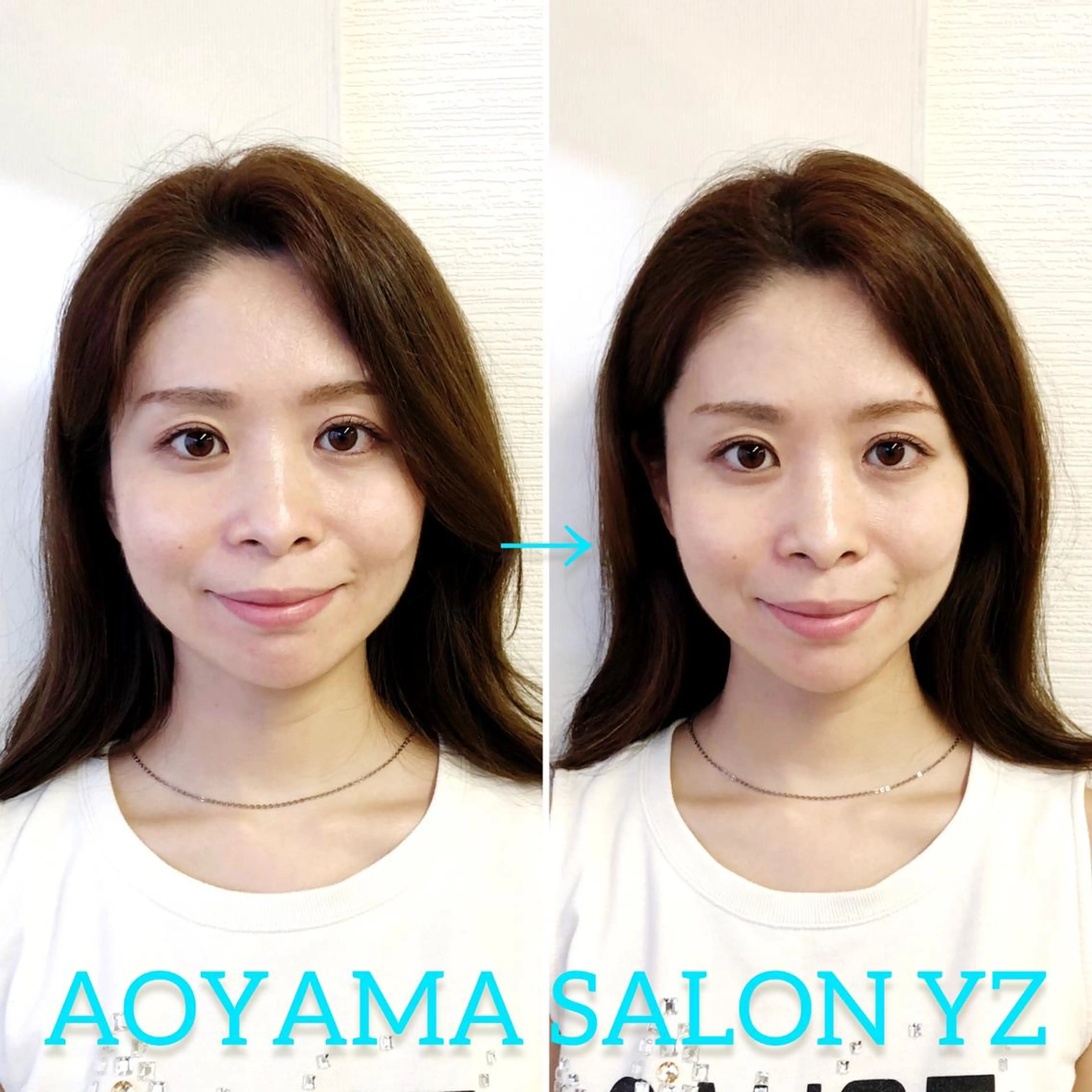 渋谷 小顔美容鍼 専門サロン YZのエステ・リラクイメージ