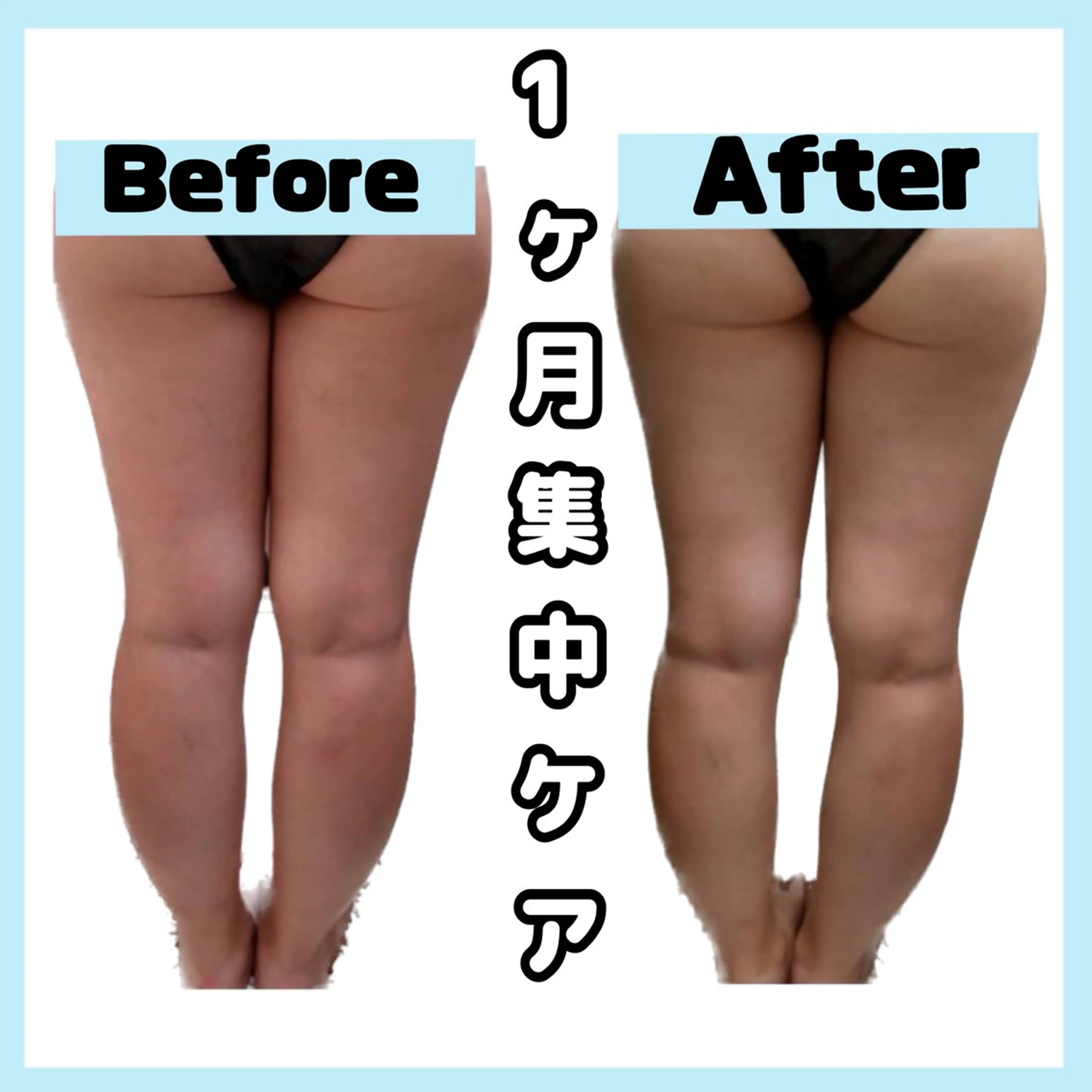 【通い放題】1ヶ月集中ケア☀️ｷｬﾋﾞﾃｰｼｮﾝ/痩身/ﾌｪｲｼｬﾙ60分コース回数制限なし🙅‍♀️ 人数限定⚠️の写真