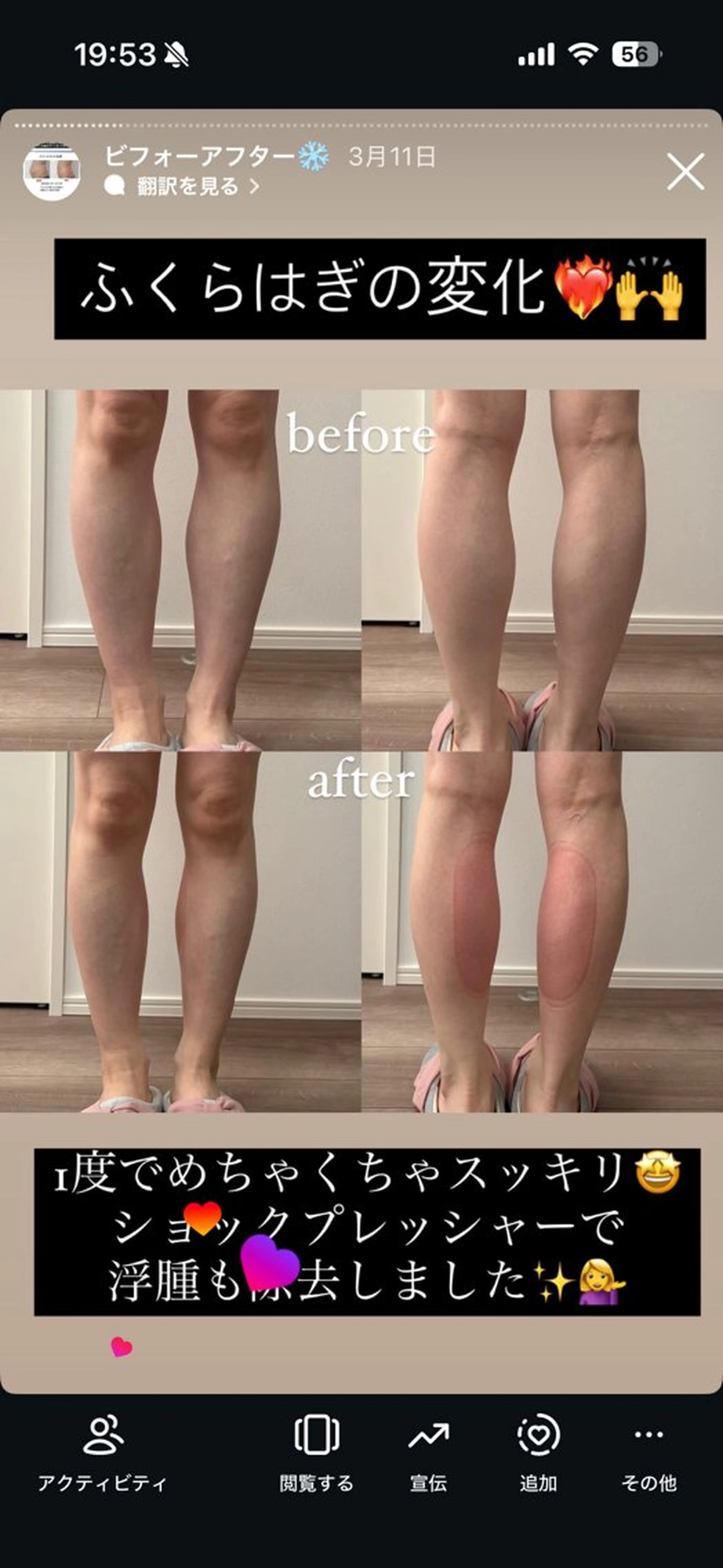 石巻 冷却痩身 Miiju. 鈴木のエステ・リラクイメージ