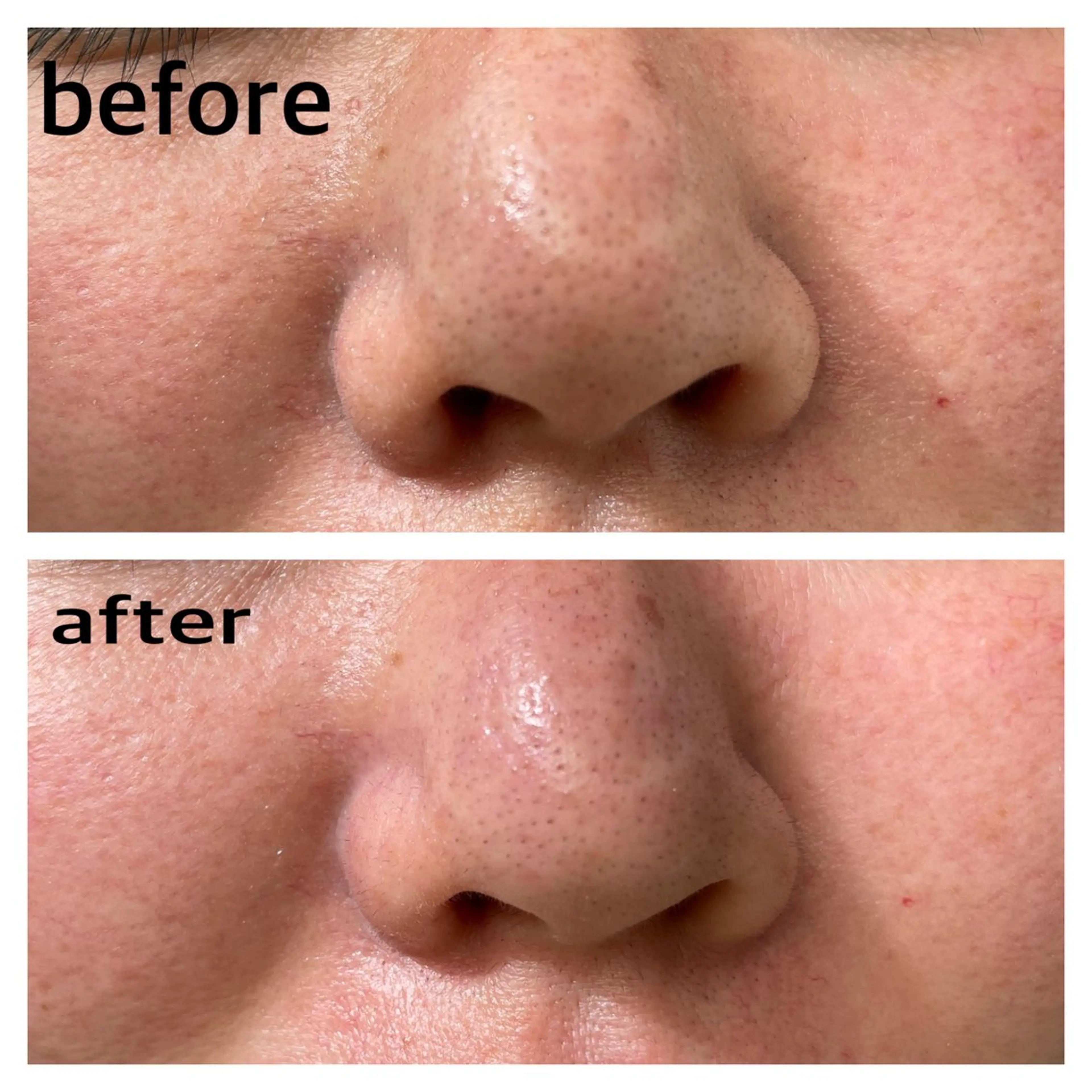 エステ une所属・une mizuhoの眉毛・アイブロウイメージ