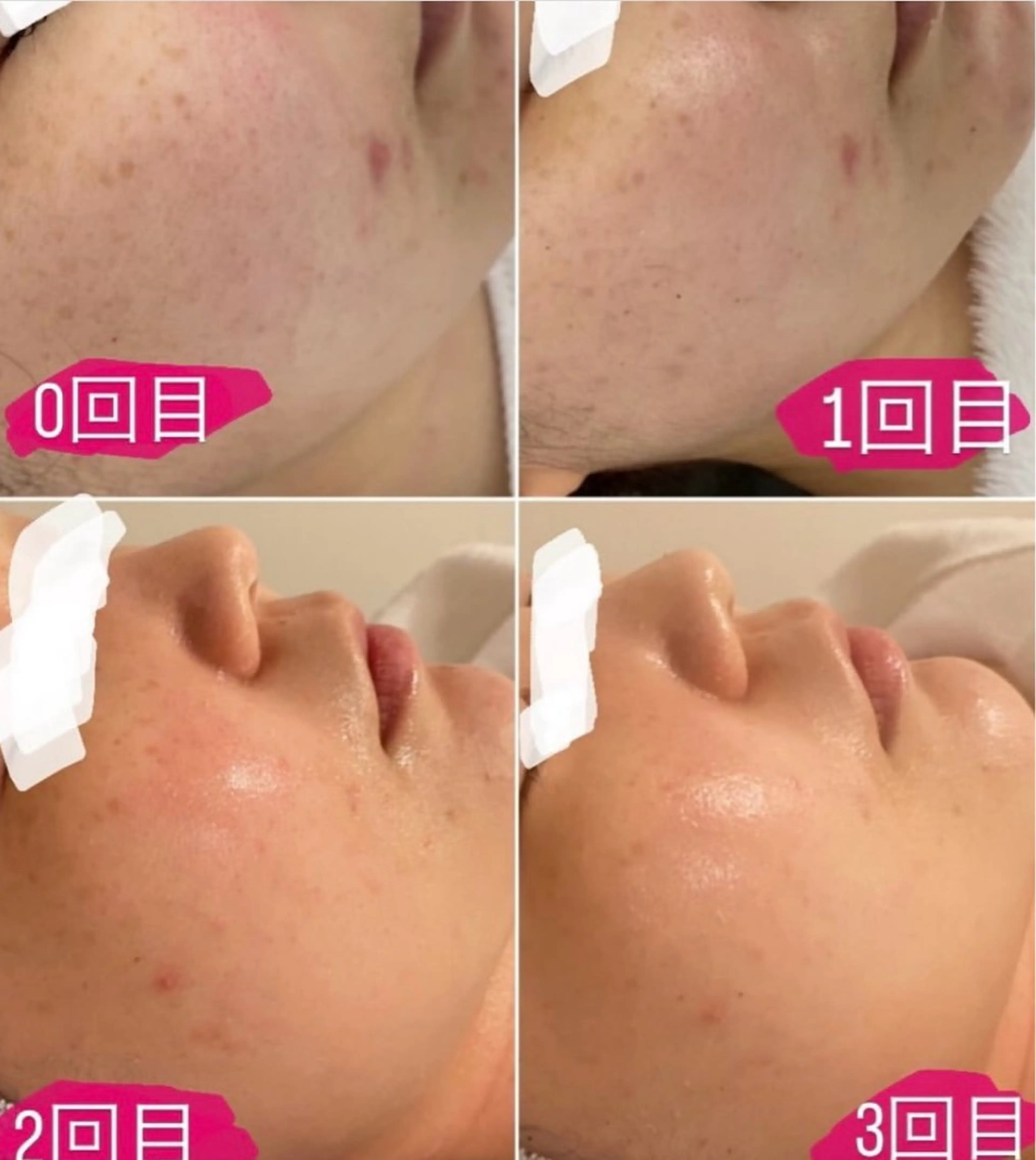 エステ Re Amply Minamiのエステ・リラクイメージ