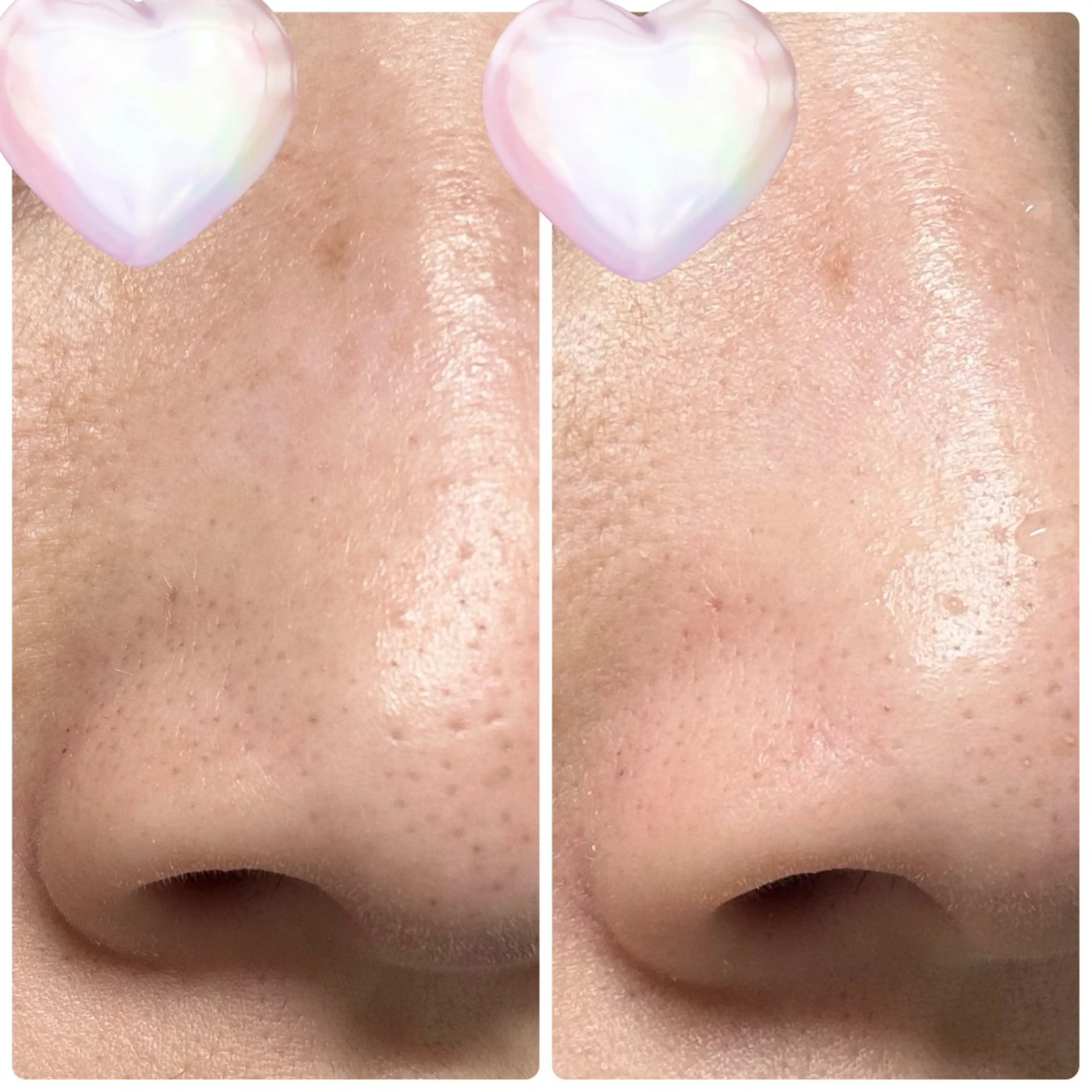 M.riche エムリシェのエステ・リラクイメージ