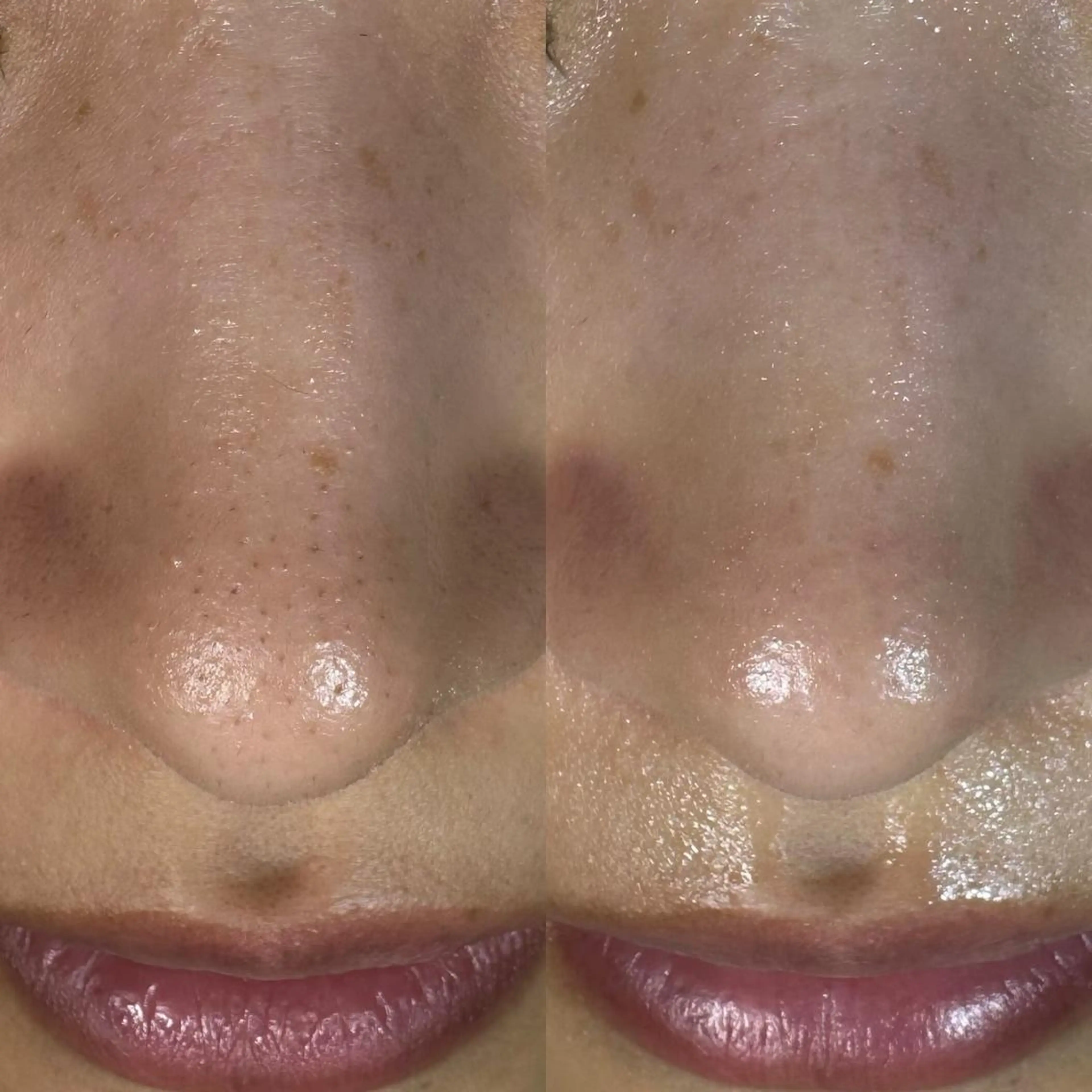 エステ 🩵atelier- 01 優奈🩵のネイルデザイン