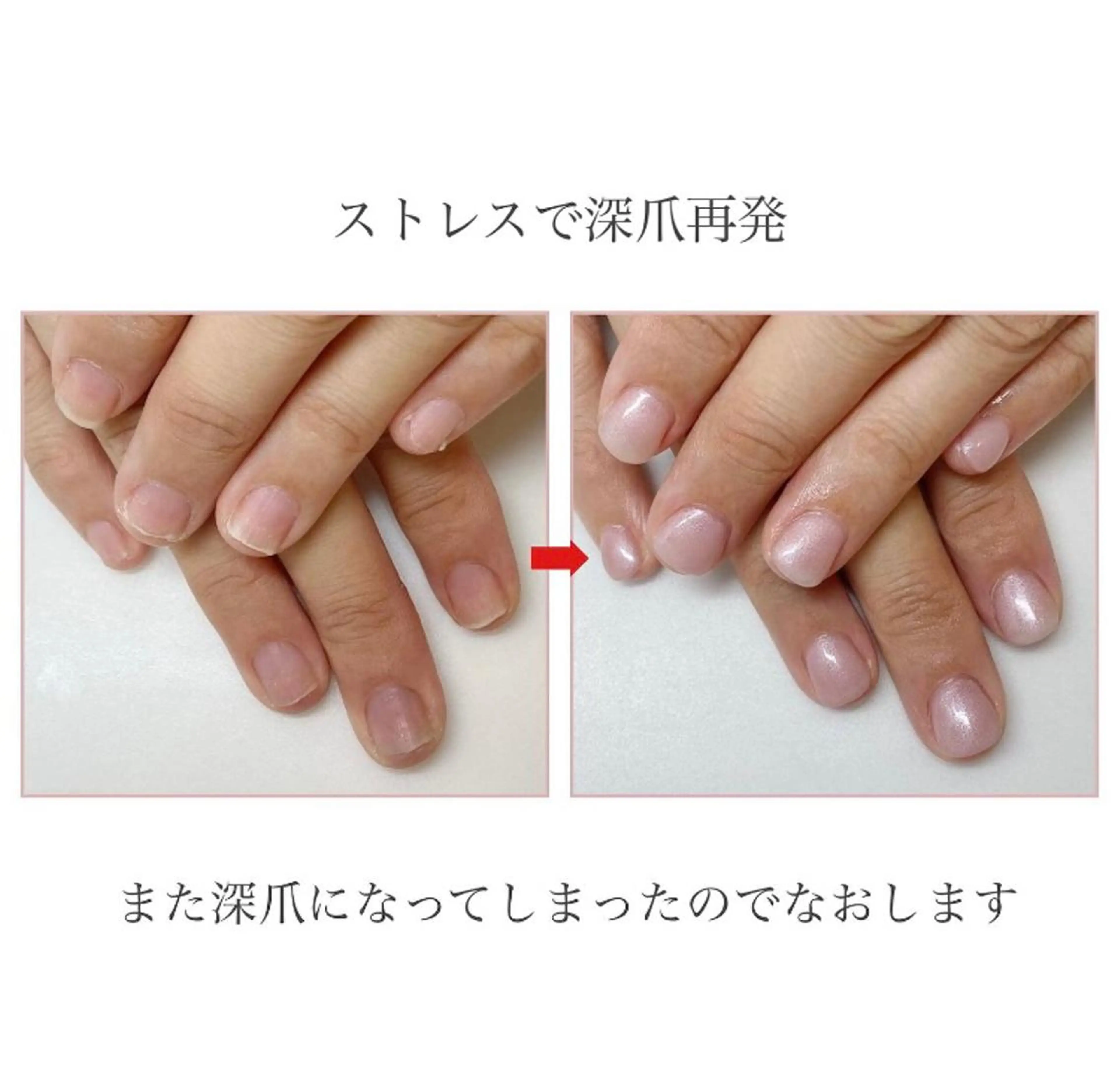 ネイル ネイルサロン アリュームのネイルデザイン