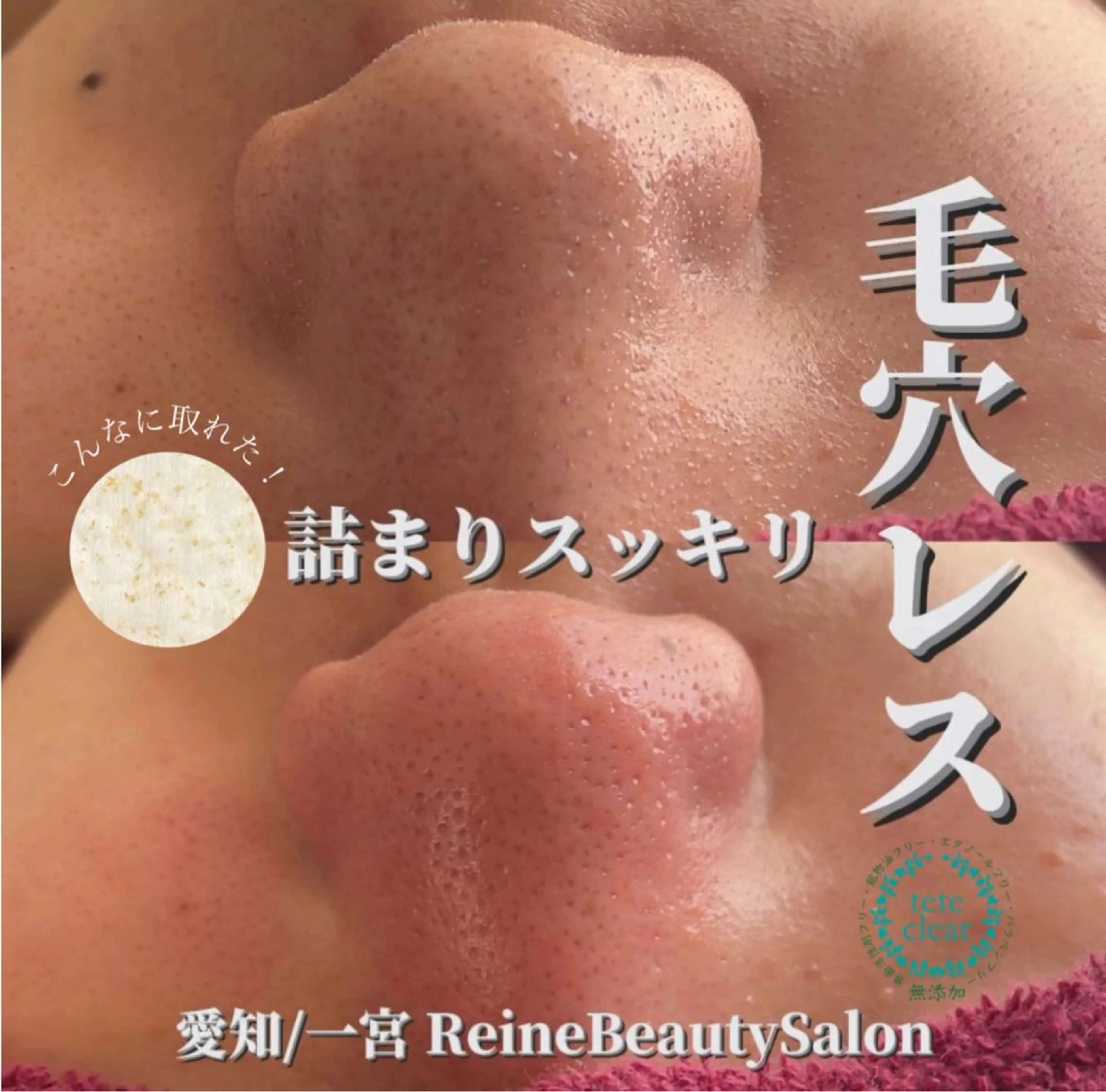 毛穴/シミ肝斑/脱毛 横山梨里のエステ・リラクイメージ