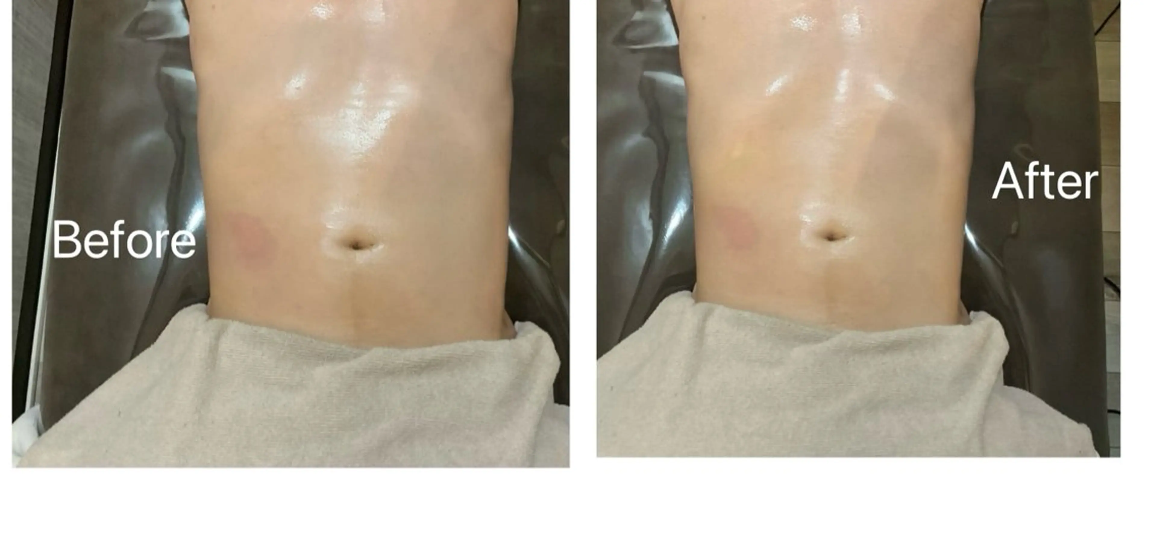 メンズ 林 絵美のエステ・リラクイメージ