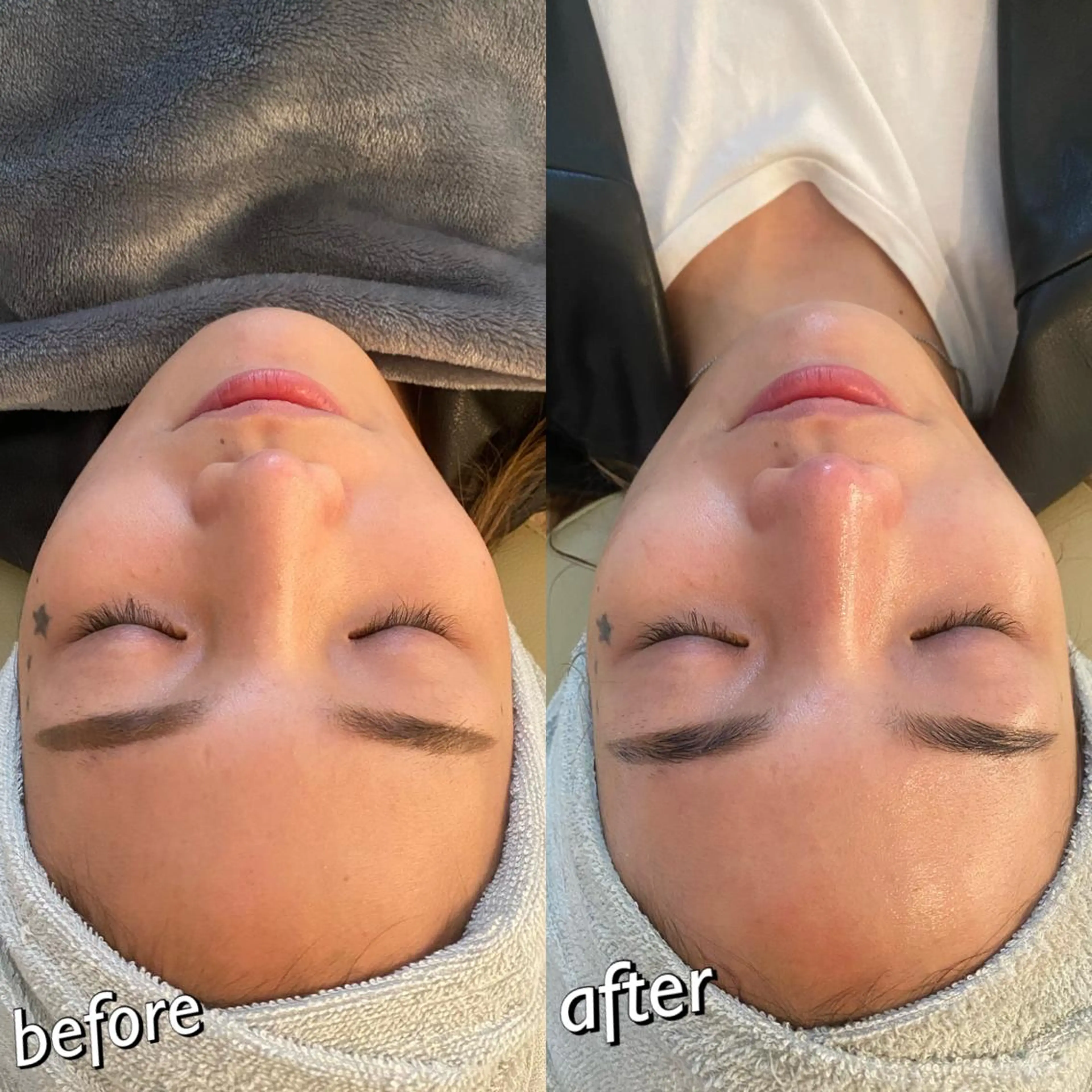 うなじ脱毛/美肌脱毛 LABELのエステ・リラクイメージ