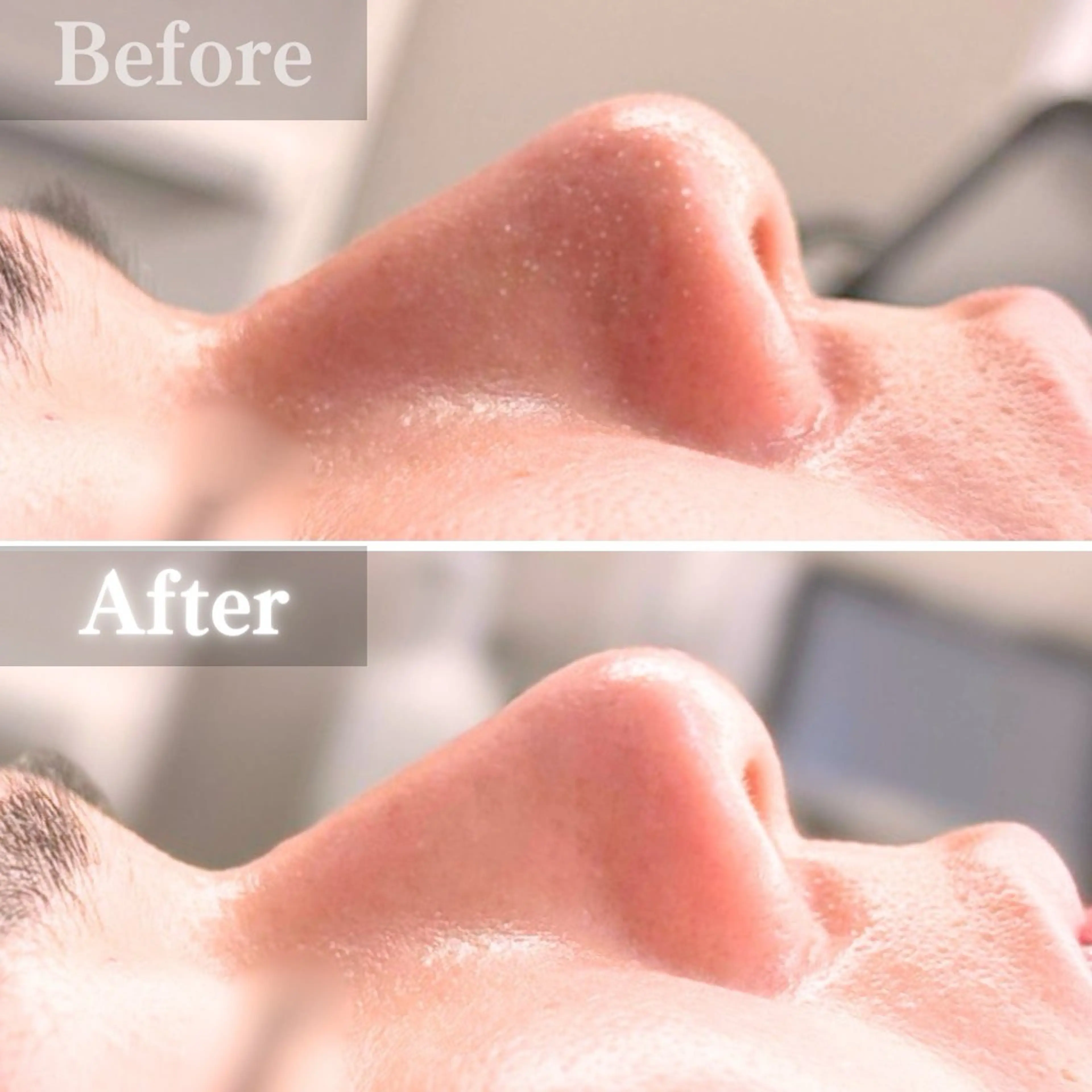 エステ 毛穴洗浄特化🫧 オオツカのエステ・リラクイメージ