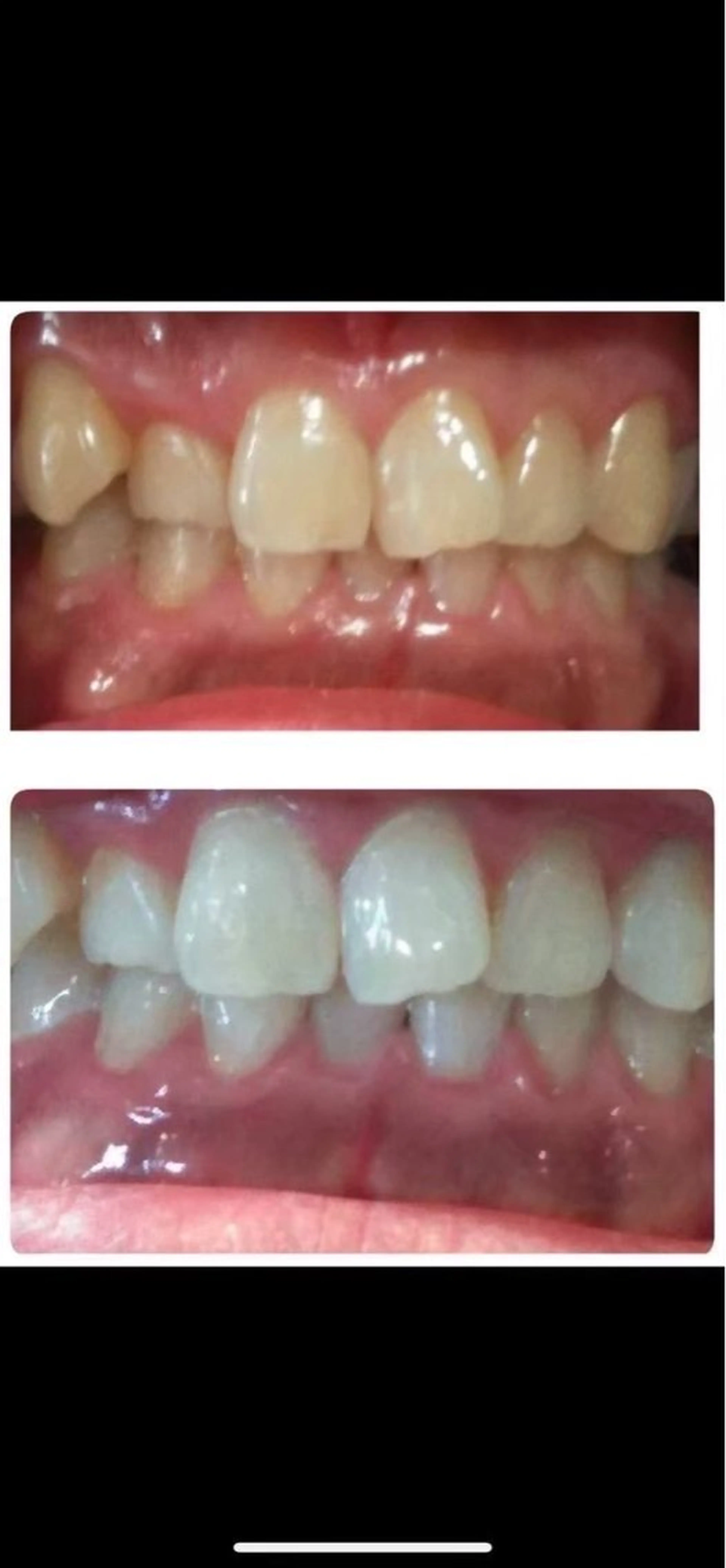 その他 ルミナホワイト 店長 もえかのその他イメージ