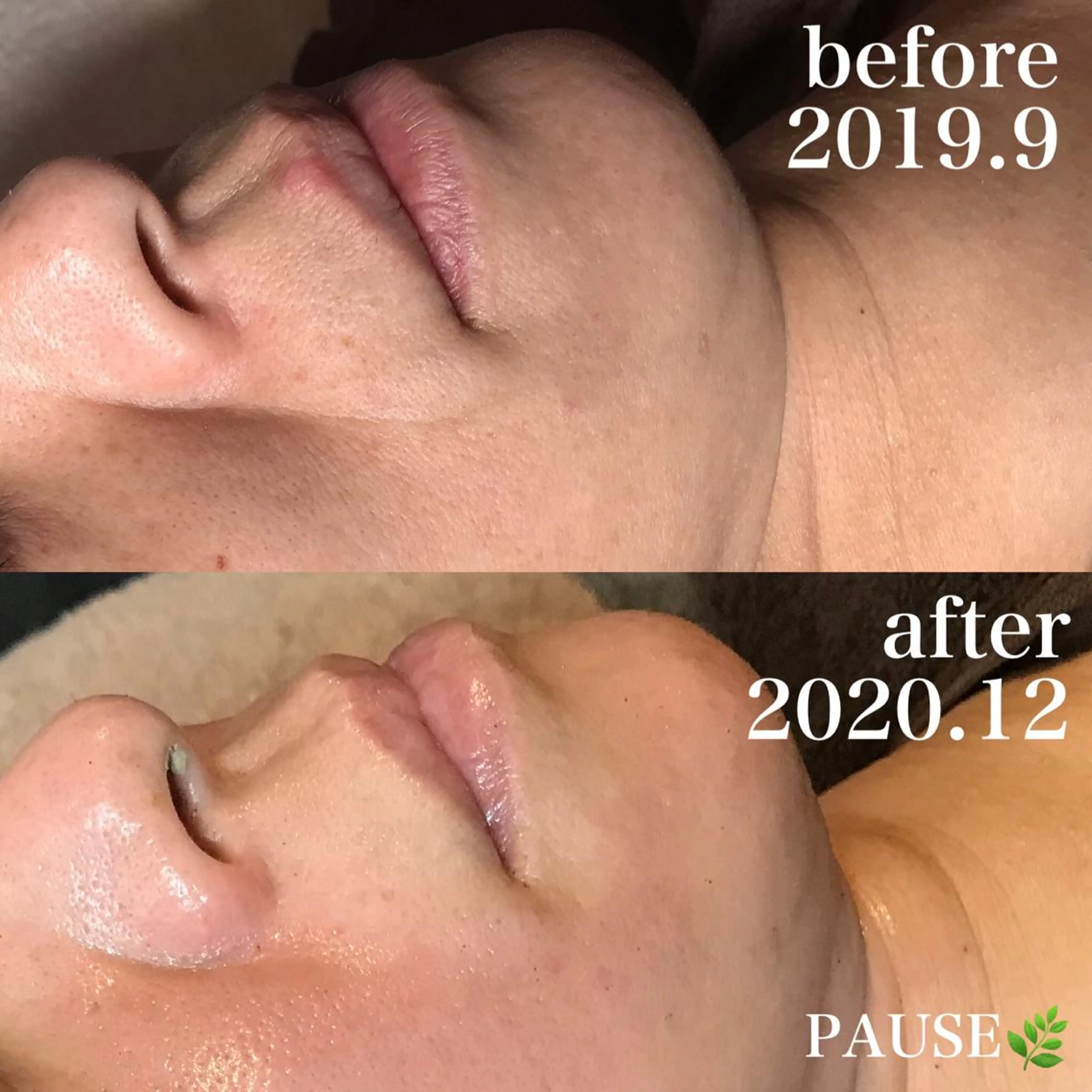 エステ 浜野 恵美のエステ・リラクイメージ