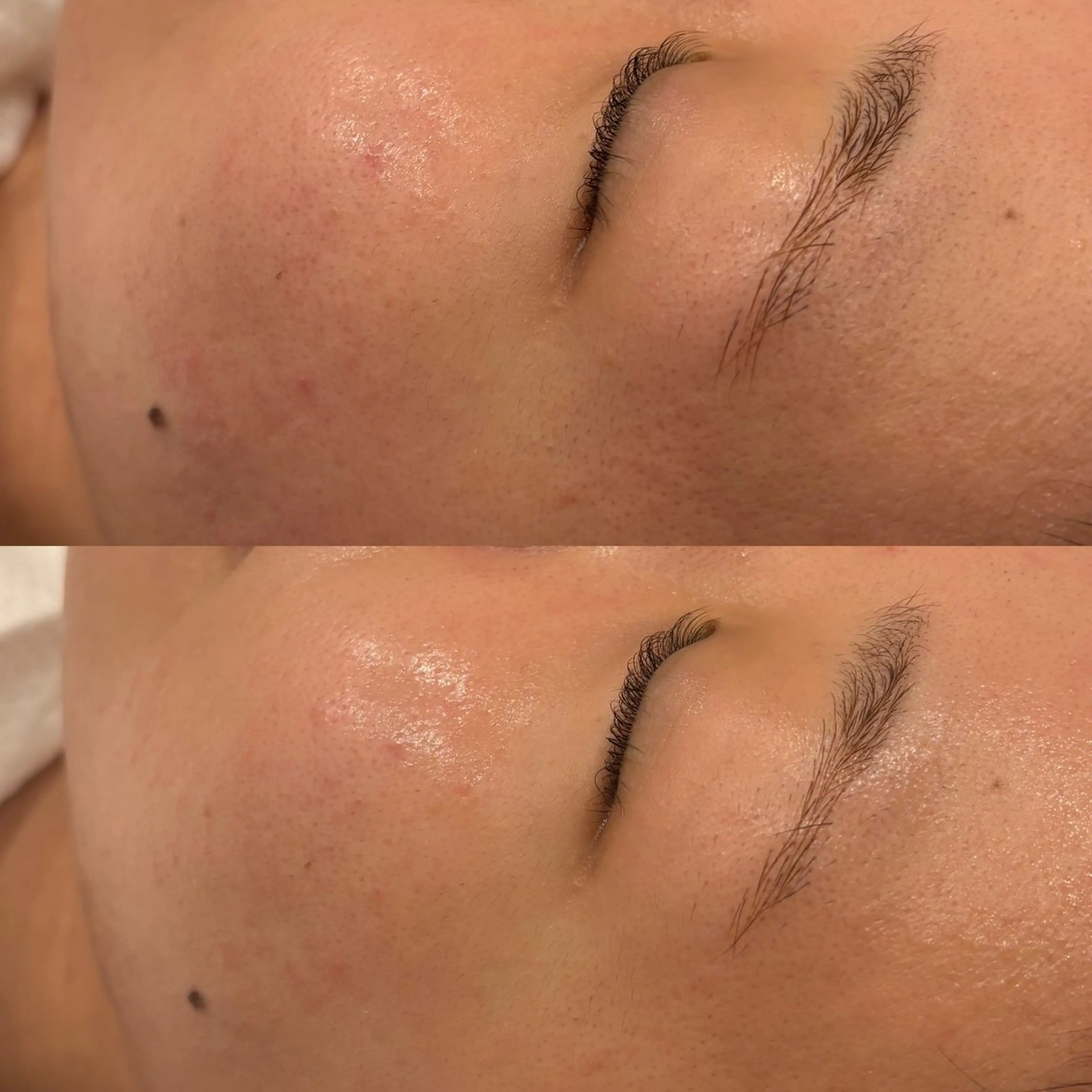 chika🦋 ハリラウンジ恵比寿のエステ・リラクイメージ