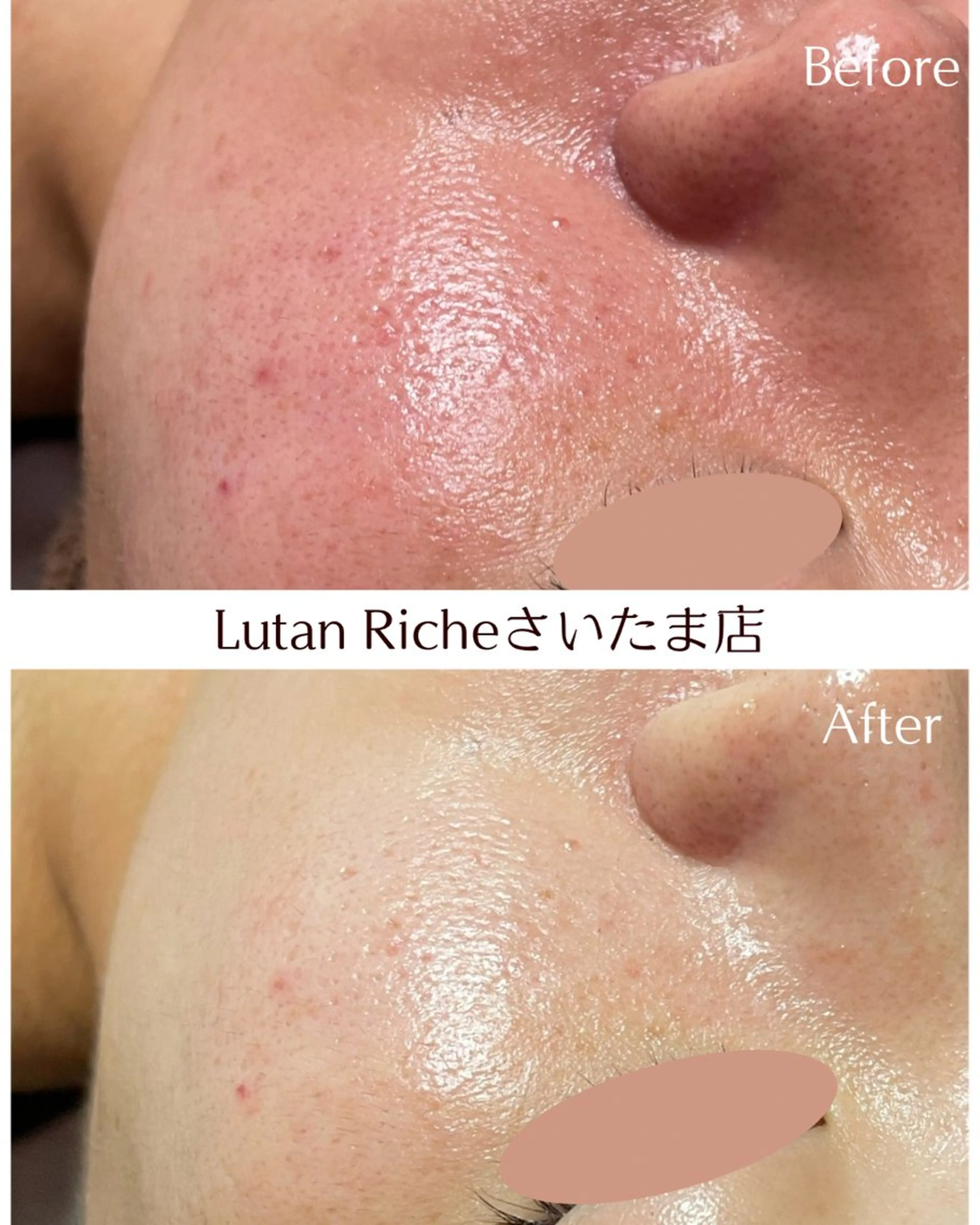 ルタンリッシュ さいたま店のエステ・リラクイメージ