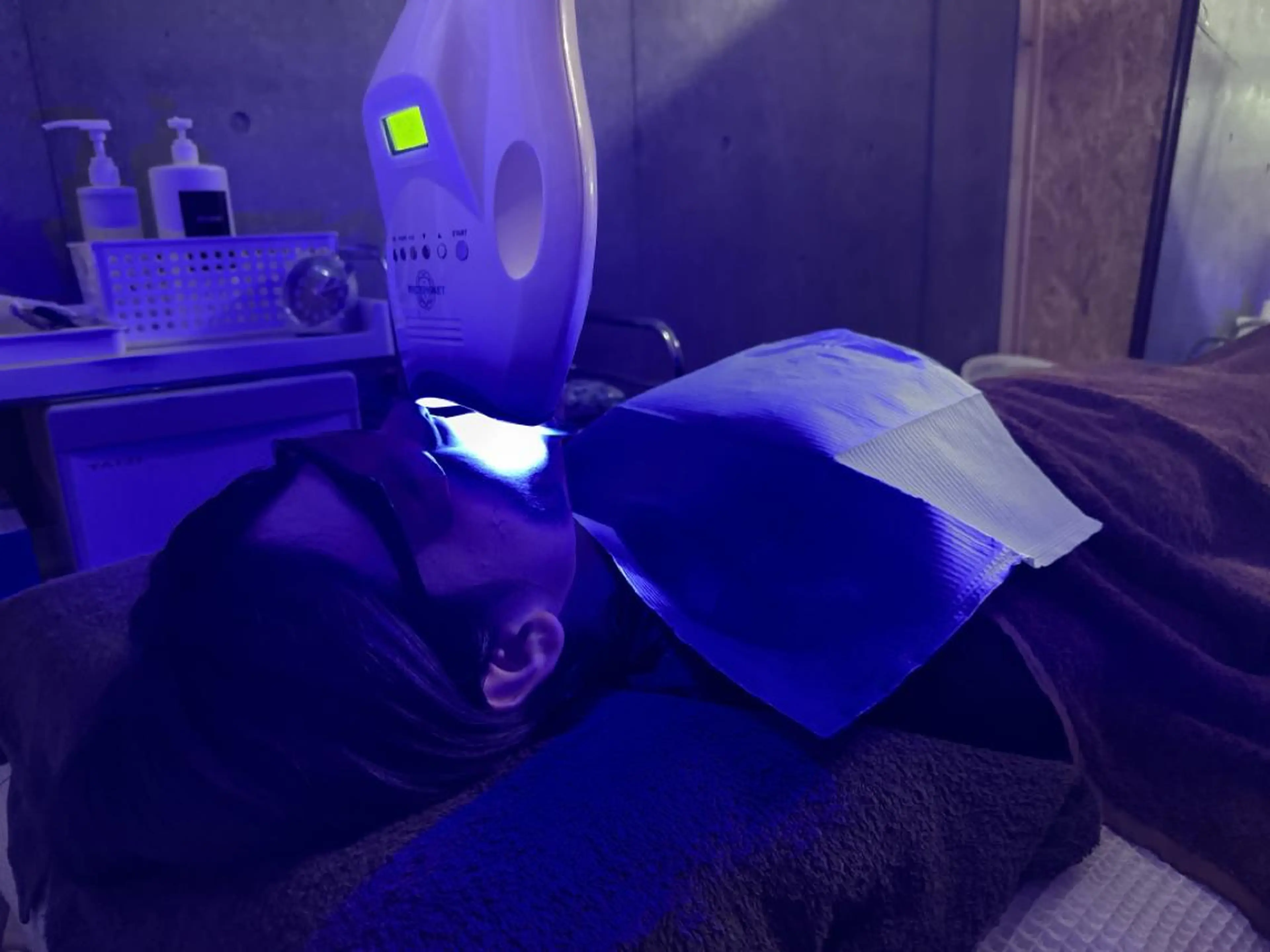 その他 ホワイトニングジム 池袋のその他イメージ