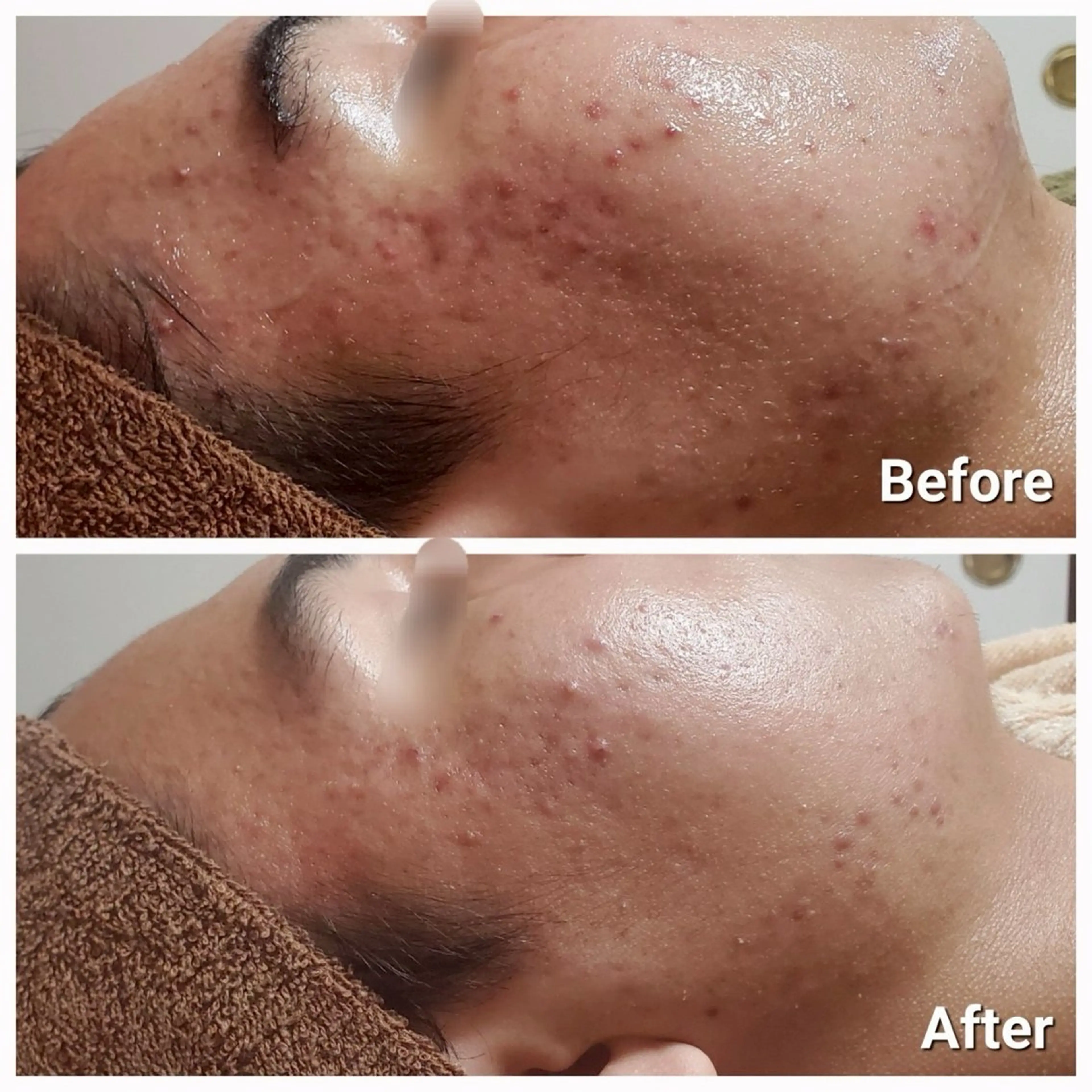 ハーブピーリング専門 葵/LUNEAのエステ・リラクイメージ