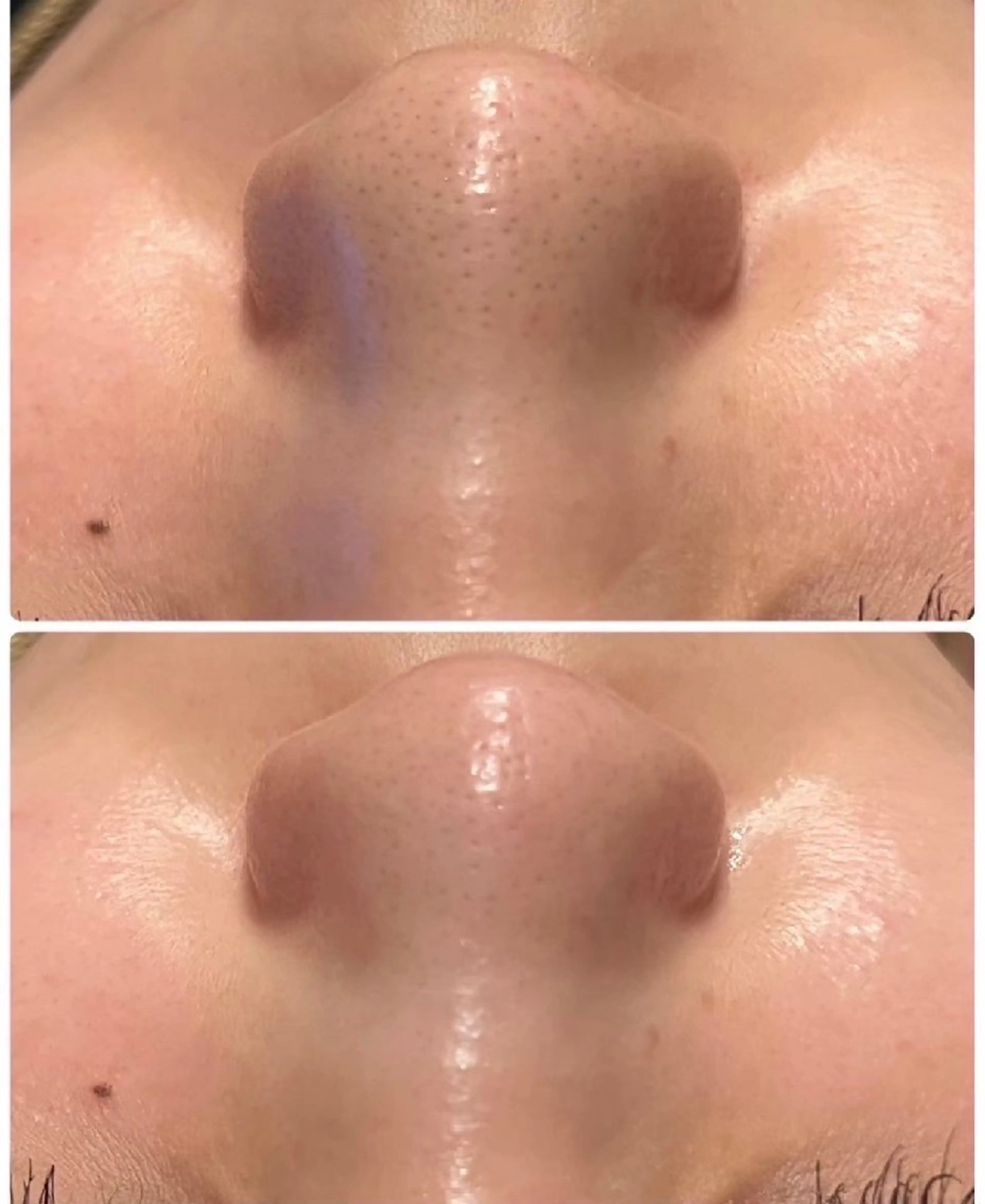 エステ TLIENGLE高宮 エステ・ネイルのエステ・リラクイメージ