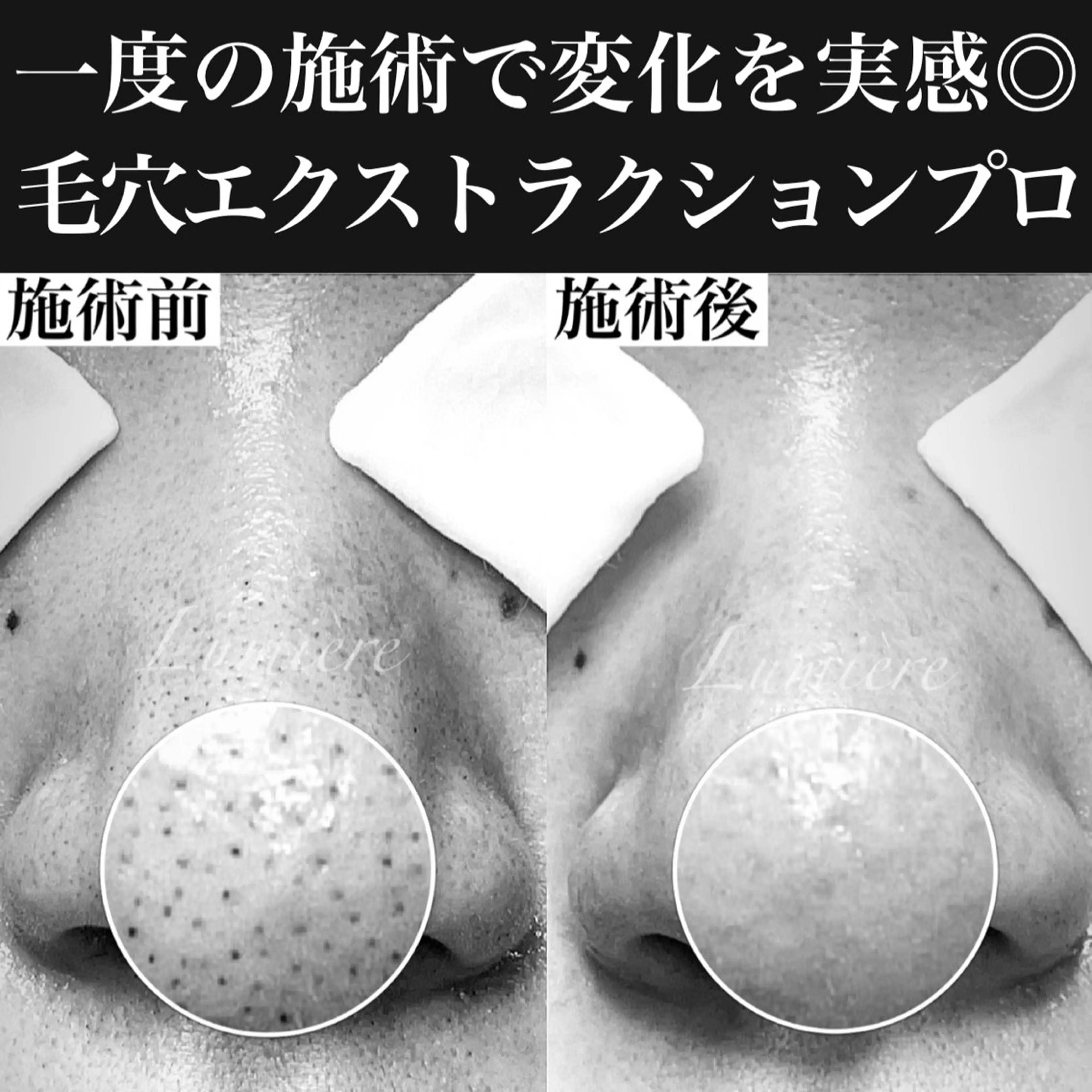 エステ マツヤニワックス専門 堂山町 ルミエールのエステ・リラクイメージ